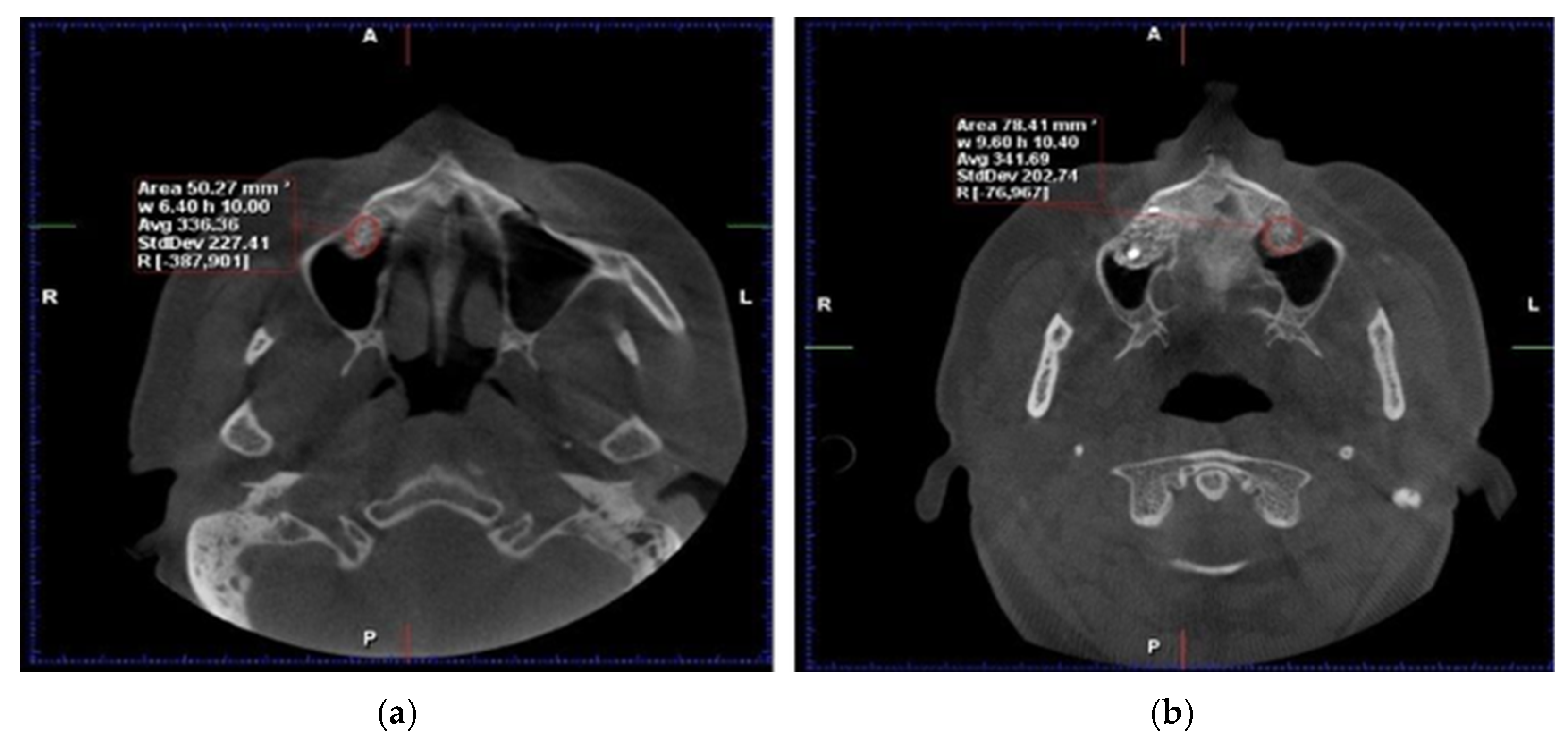 Dentistry 13 00565 g001
