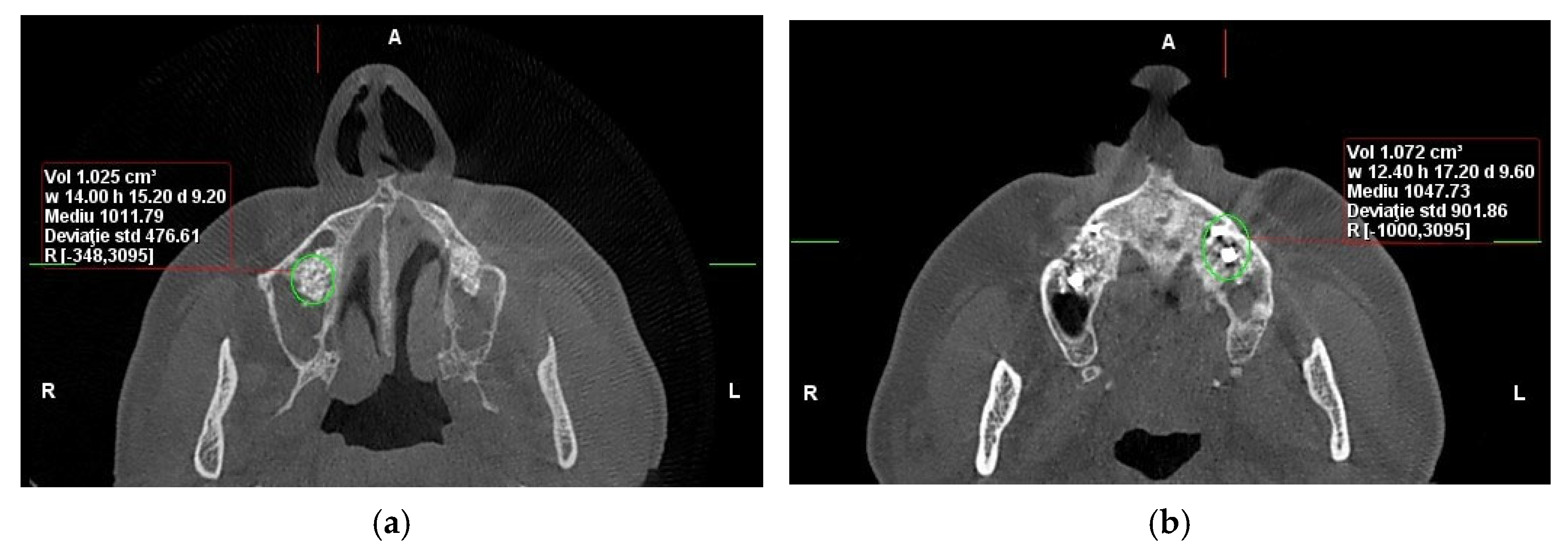 Dentistry 13 00565 g002