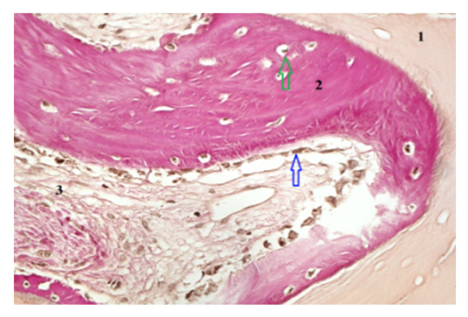 Dentistry 13 00565 g003