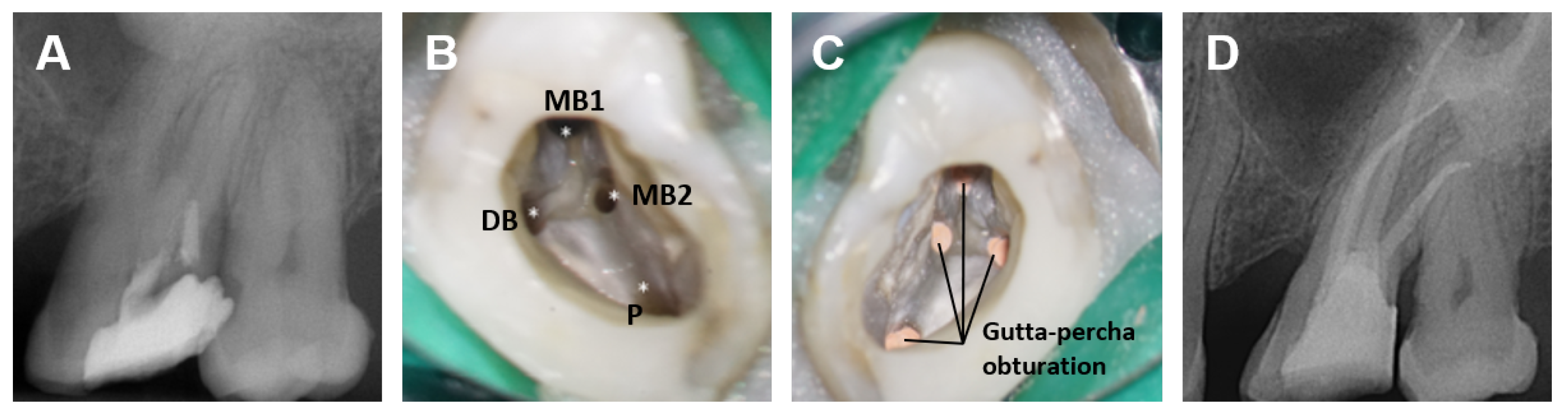 Dentistry 13 00579 g001 Dentistry 13 00579 g001