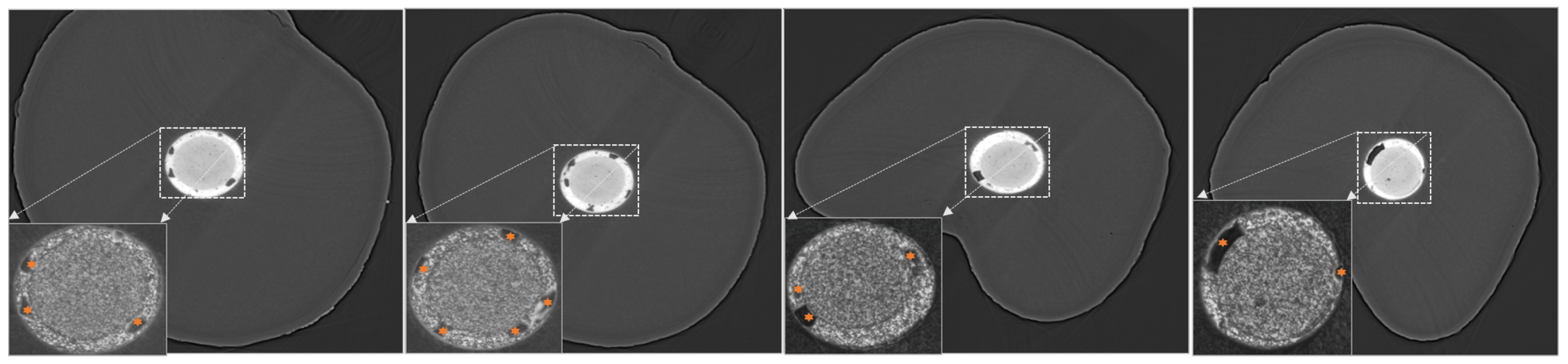 Dentistry 13 00579 g004 Dentistry 13 00579 g004