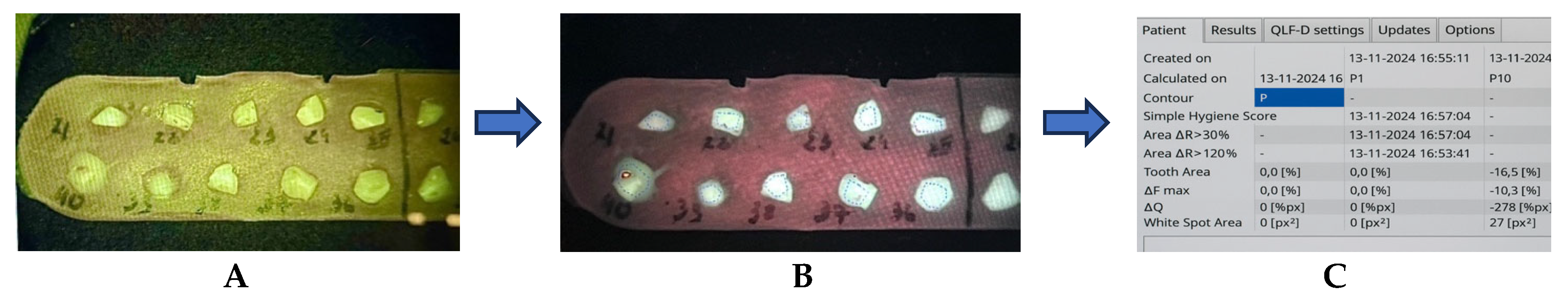 Dentistry 13 00588 g001 Dentistry 13 00588 g001