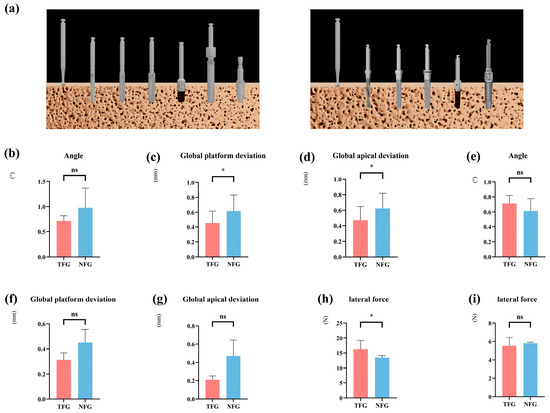 An In Vitro Analysis of Implant Site Preparation and Placement ...