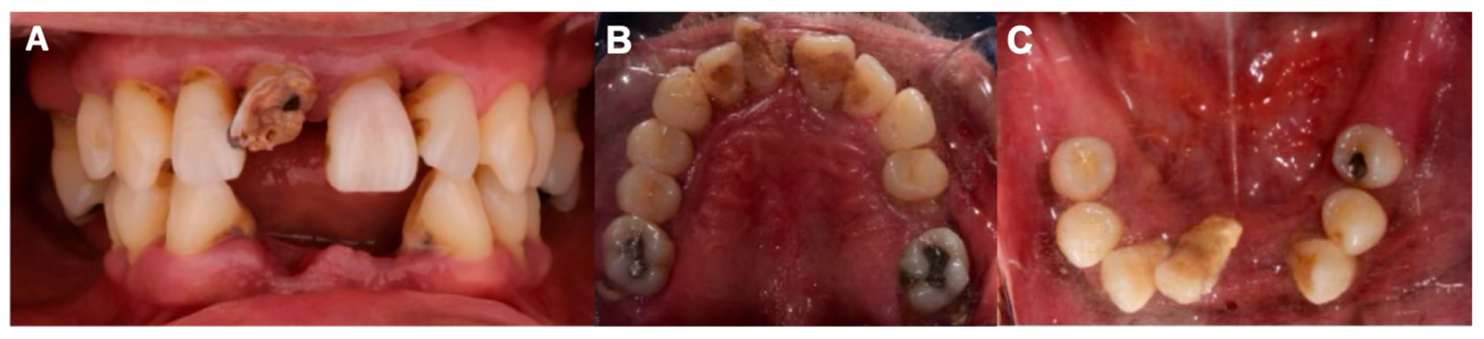 Dentistry 13 00605 g001