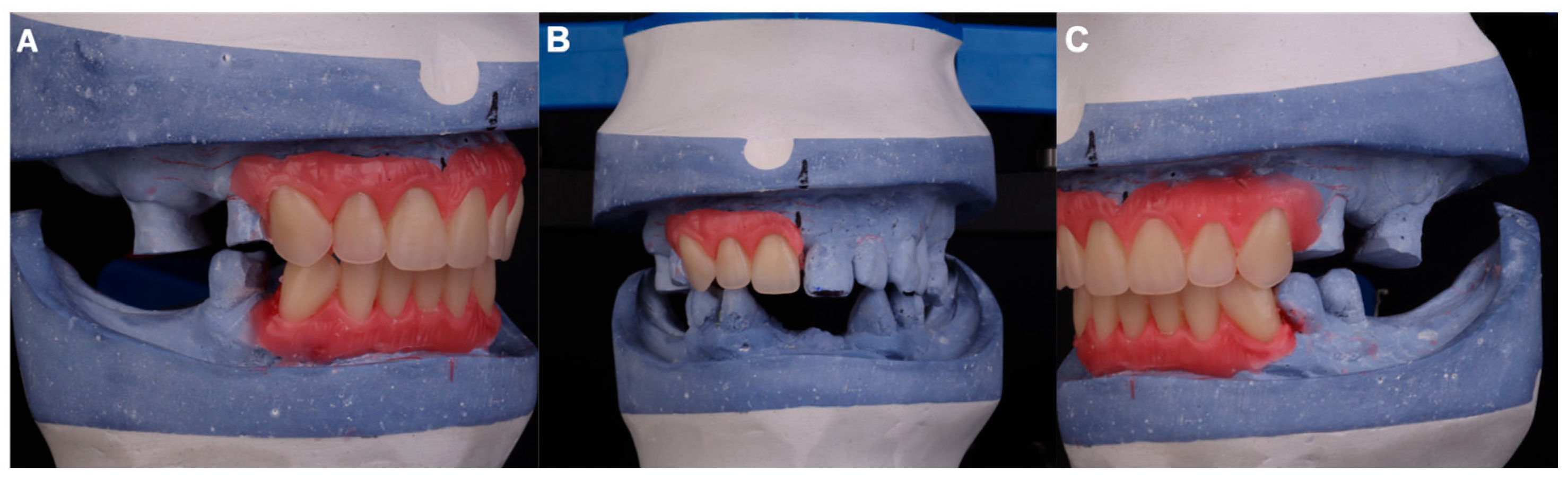 Dentistry 13 00605 g003