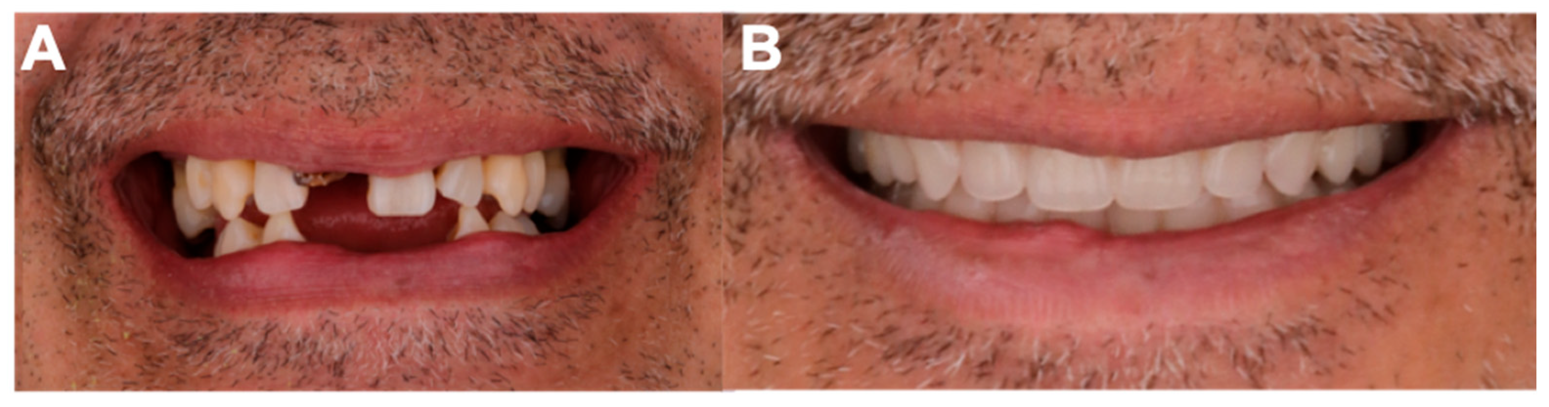 Dentistry 13 00605 g008