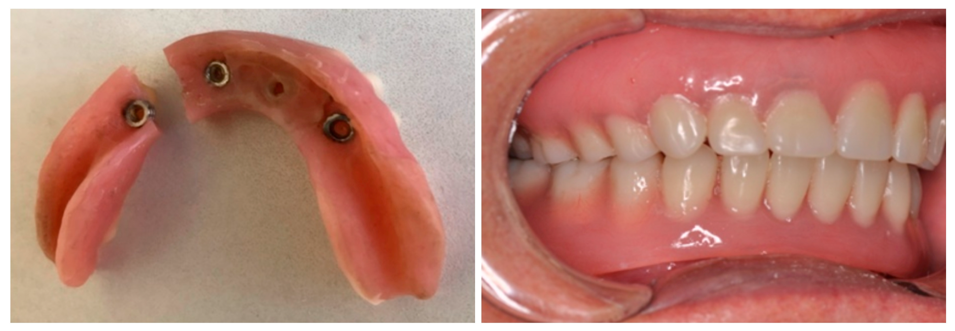 Dentistry 13 00606 g004 Dentistry 13 00606 g004