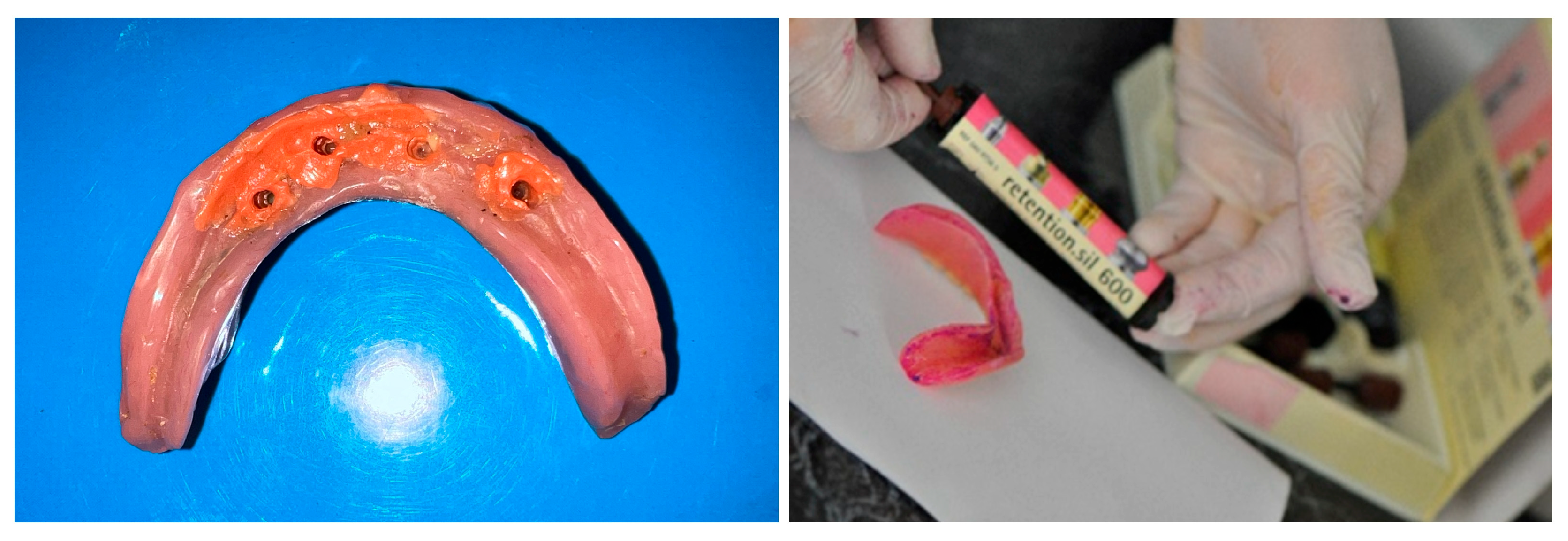 Dentistry 13 00606 g007 Dentistry 13 00606 g007