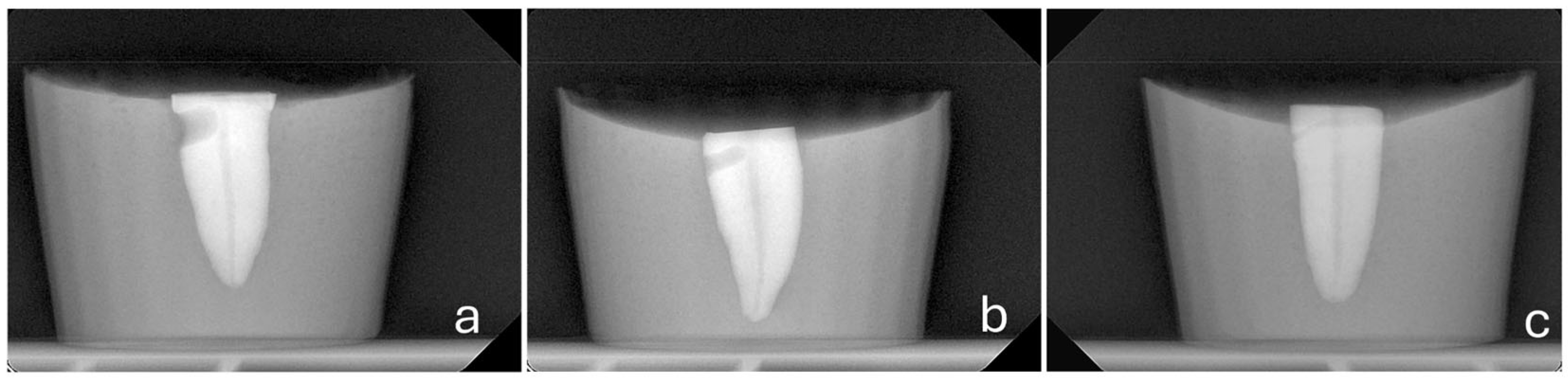 Dentistry 14 00012 g003 Dentistry 14 00012 g003