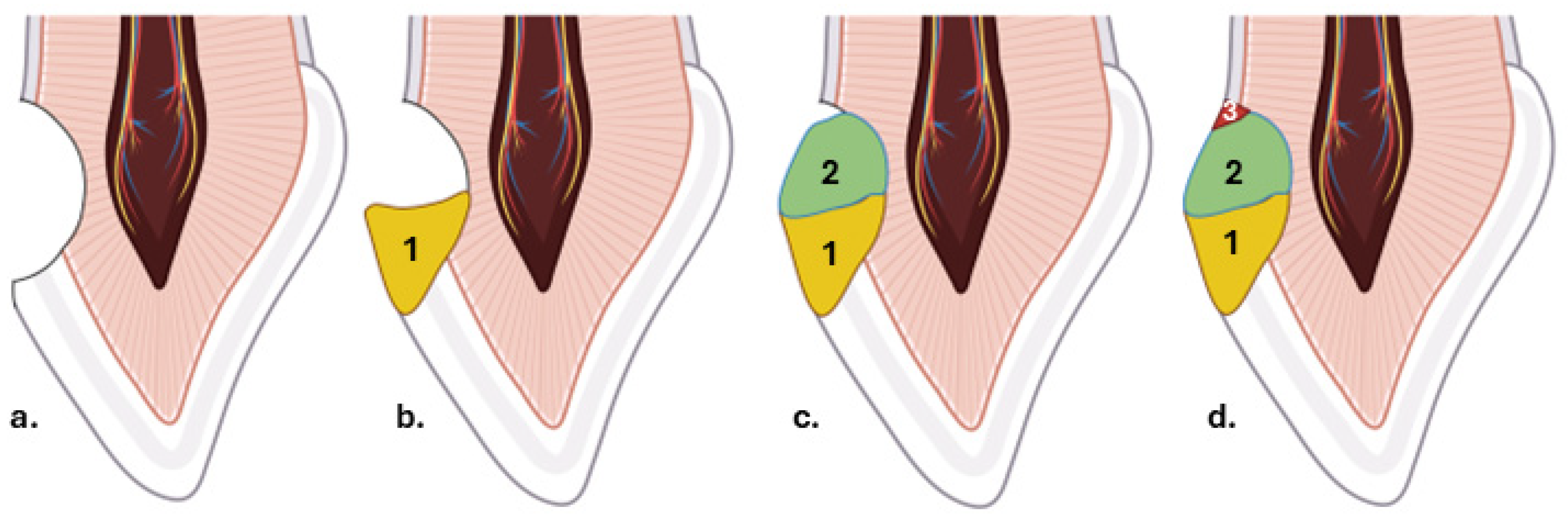 Dentistry 14 00013 g001 Dentistry 14 00013 g001
