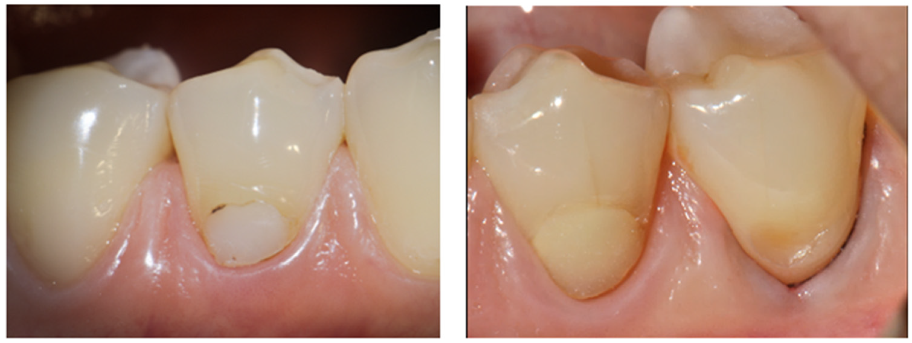 Dentistry 14 00013 g003 Dentistry 14 00013 g003