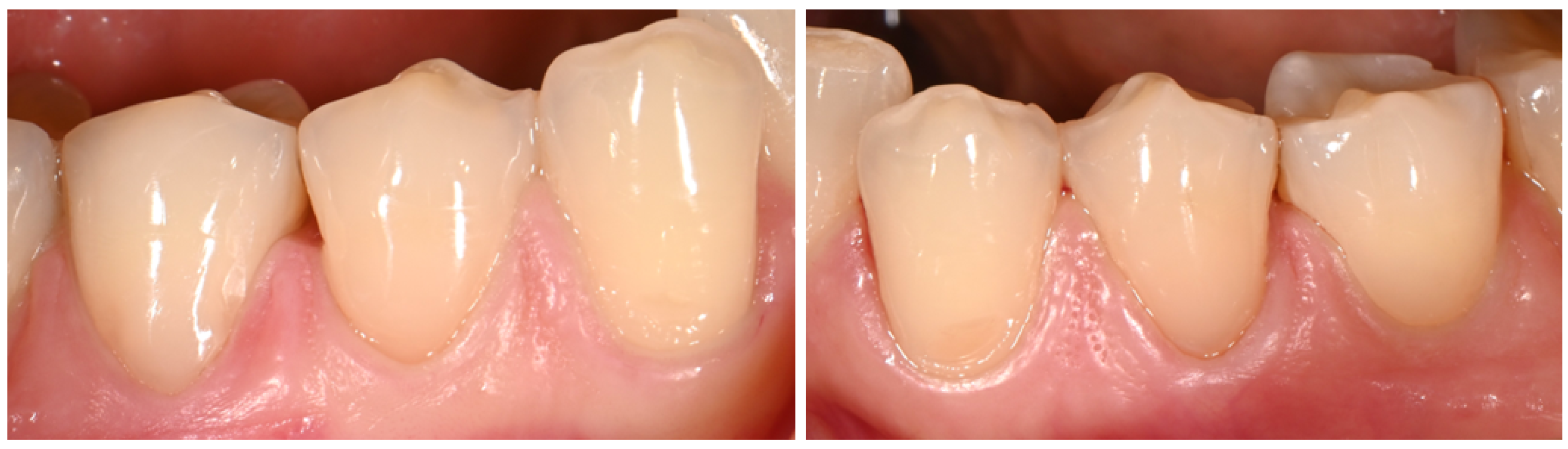 Dentistry 14 00013 g005 Dentistry 14 00013 g005