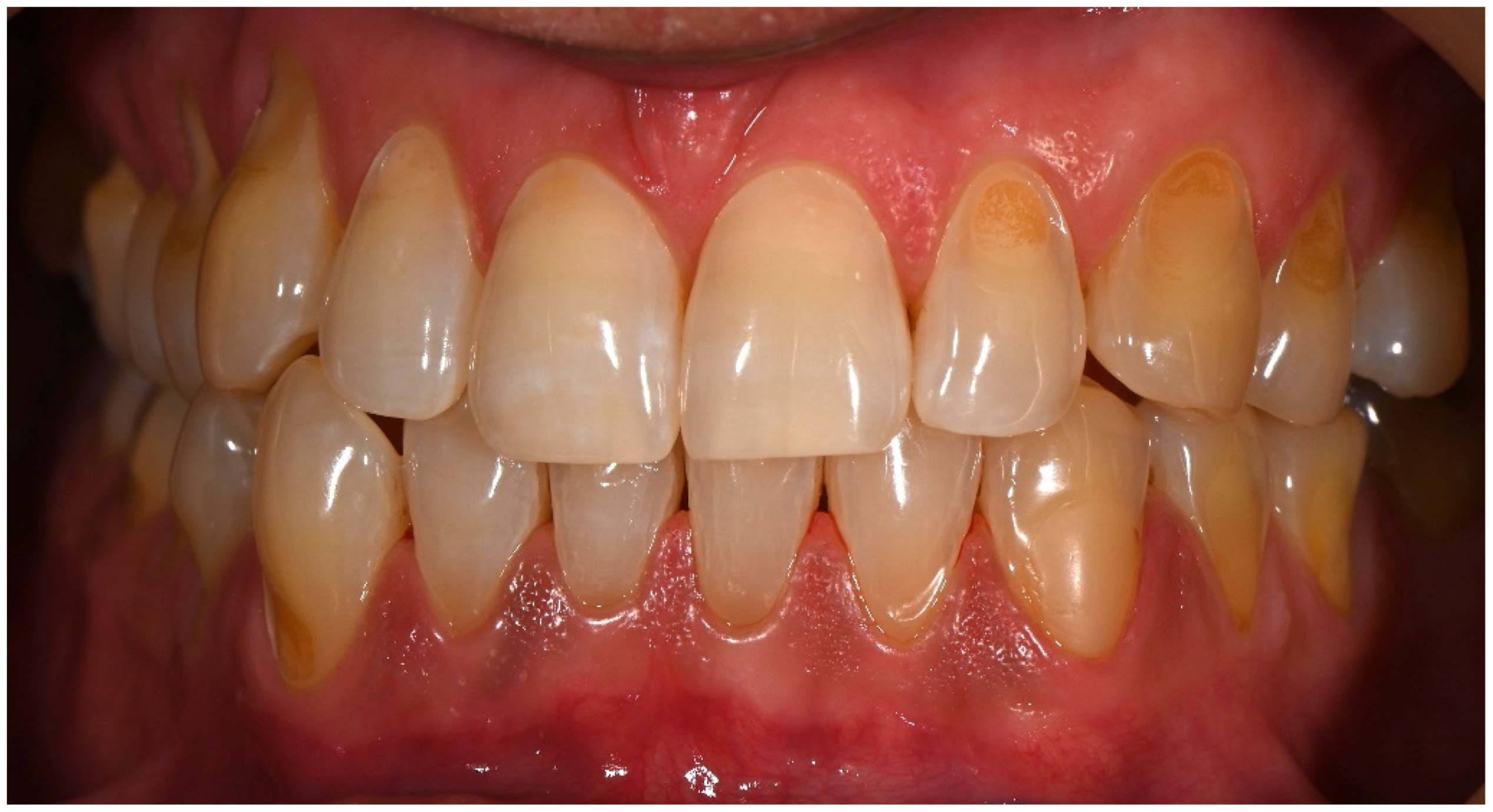 Dentistry 14 00013 g006 Dentistry 14 00013 g006