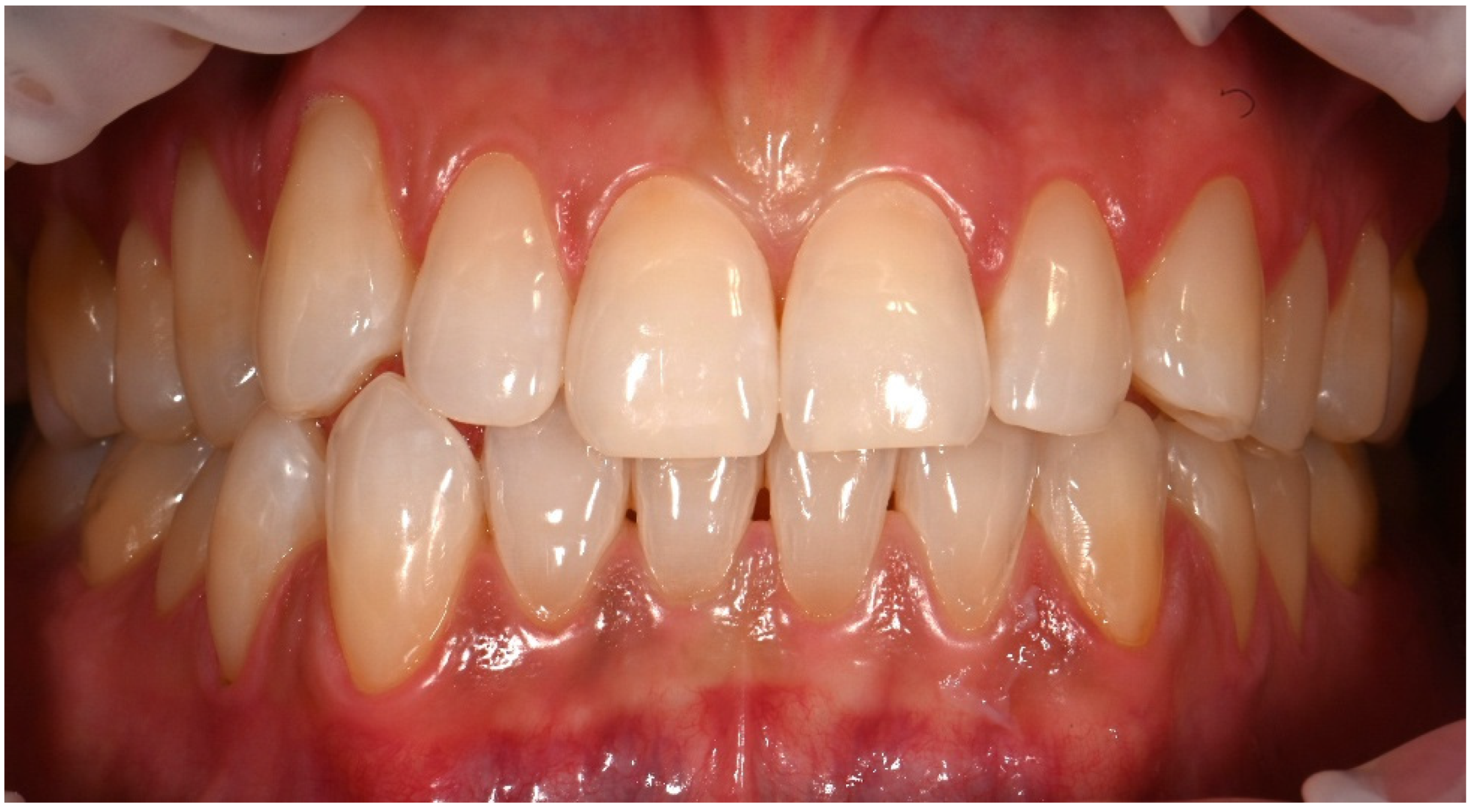 Dentistry 14 00013 g007 Dentistry 14 00013 g007