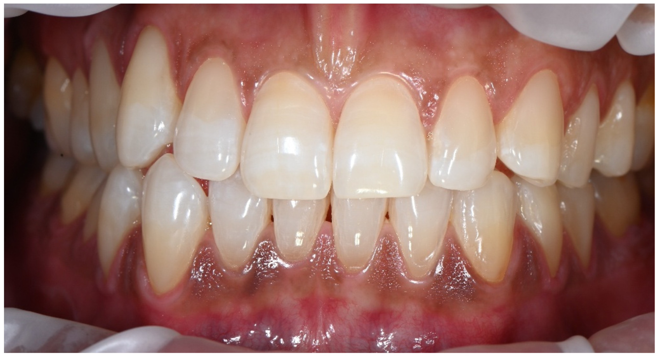 Dentistry 14 00013 g008 Dentistry 14 00013 g008