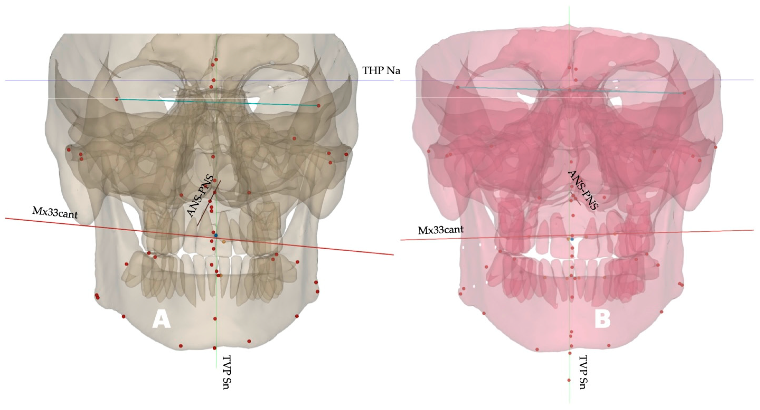 Dentistry 14 00024 g008 Dentistry 14 00024 g008