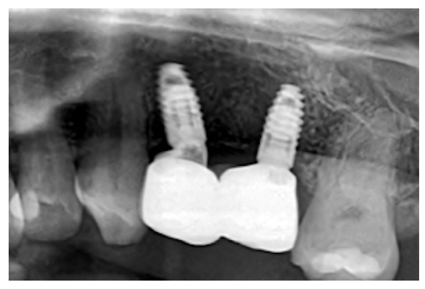Dentistry 14 00025 g005