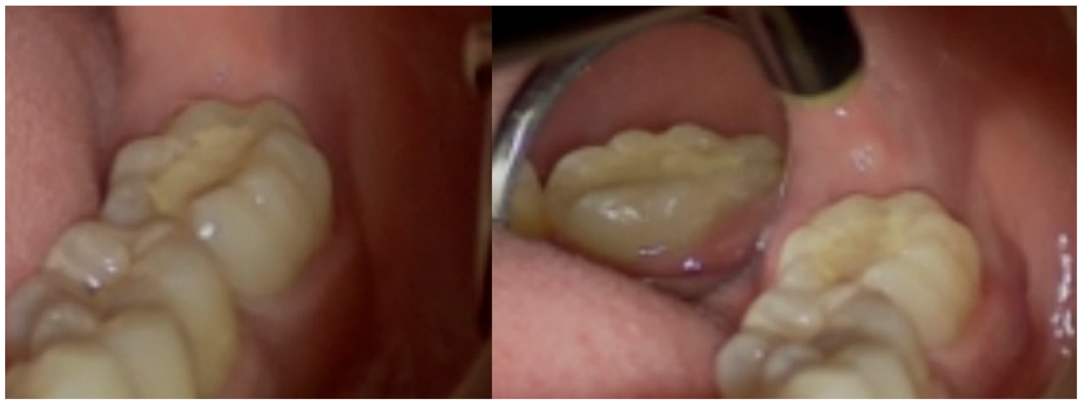 Dentistry 14 00027 g001 Dentistry 14 00027 g001