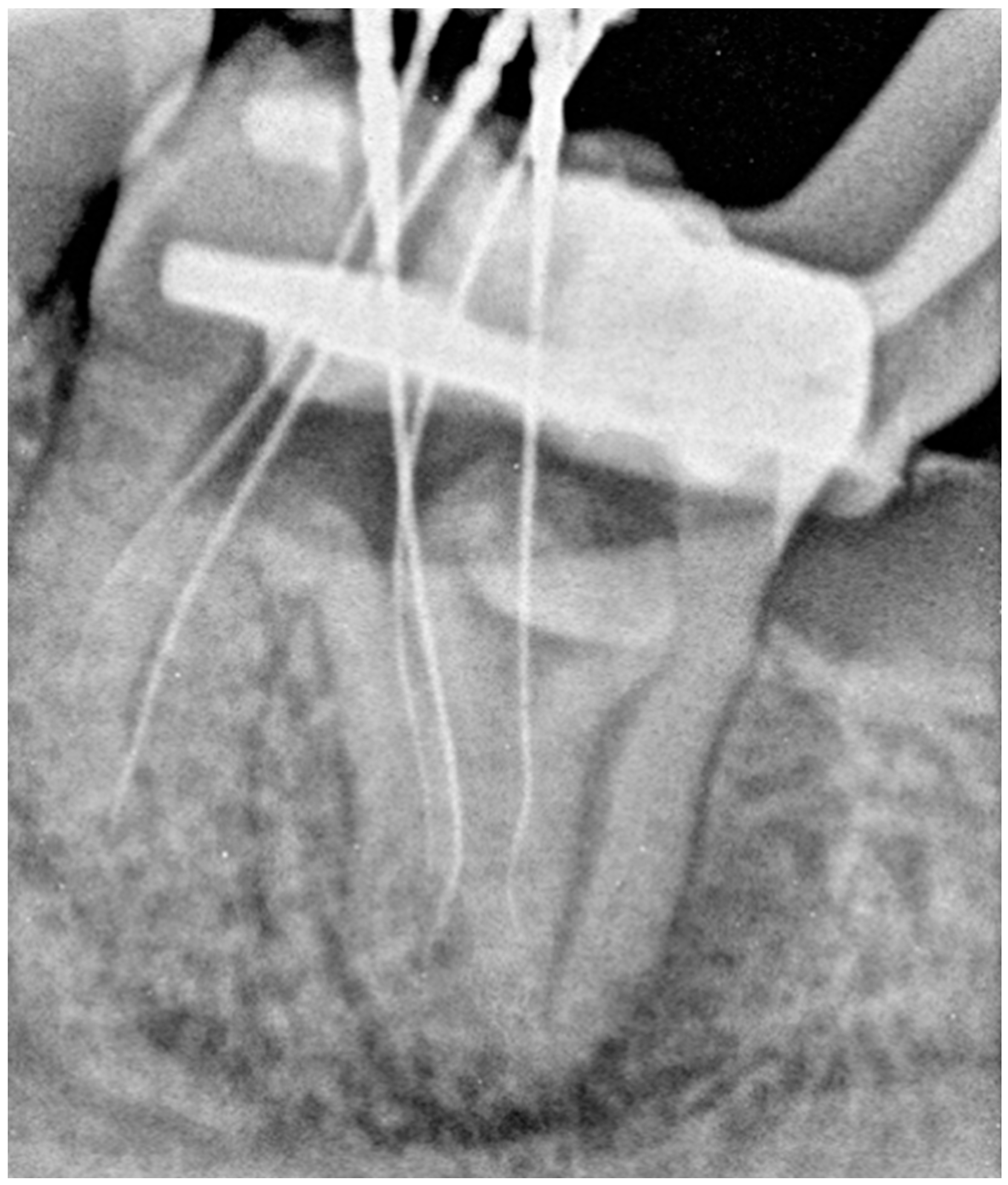 Dentistry 14 00027 g003 Dentistry 14 00027 g003