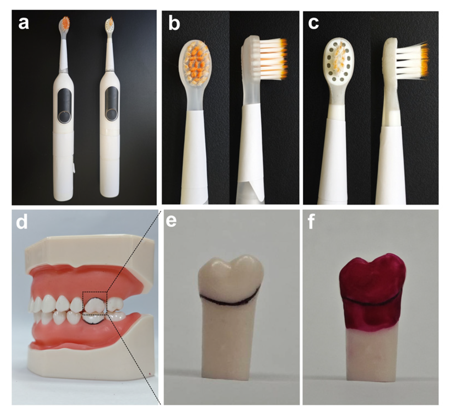 Dentistry 14 00029 g001 Dentistry 14 00029 g001