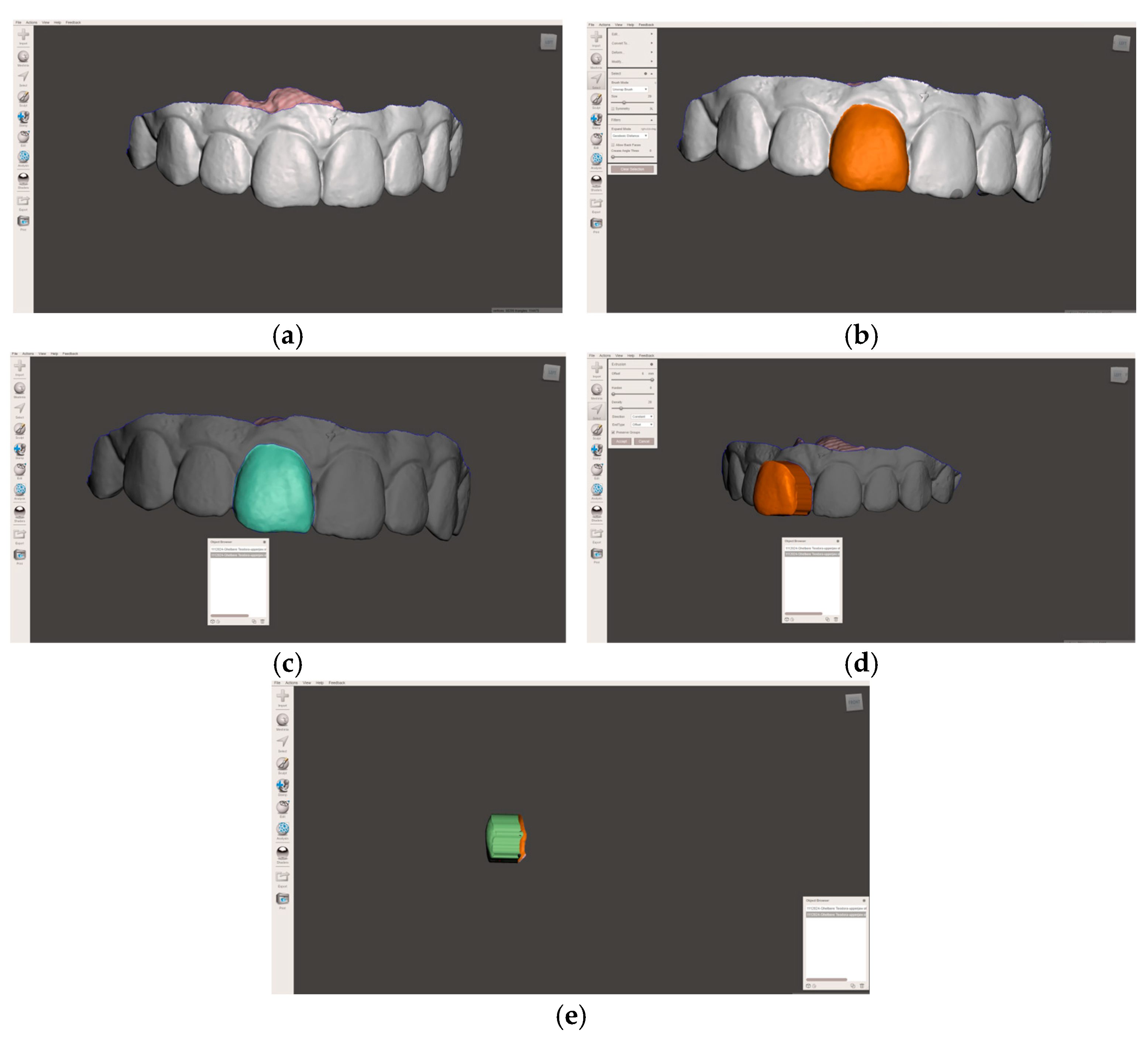 Dentistry 14 00035 g001