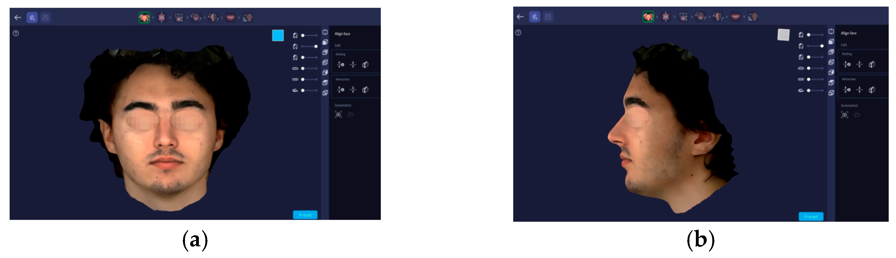 Dentistry 14 00035 g003