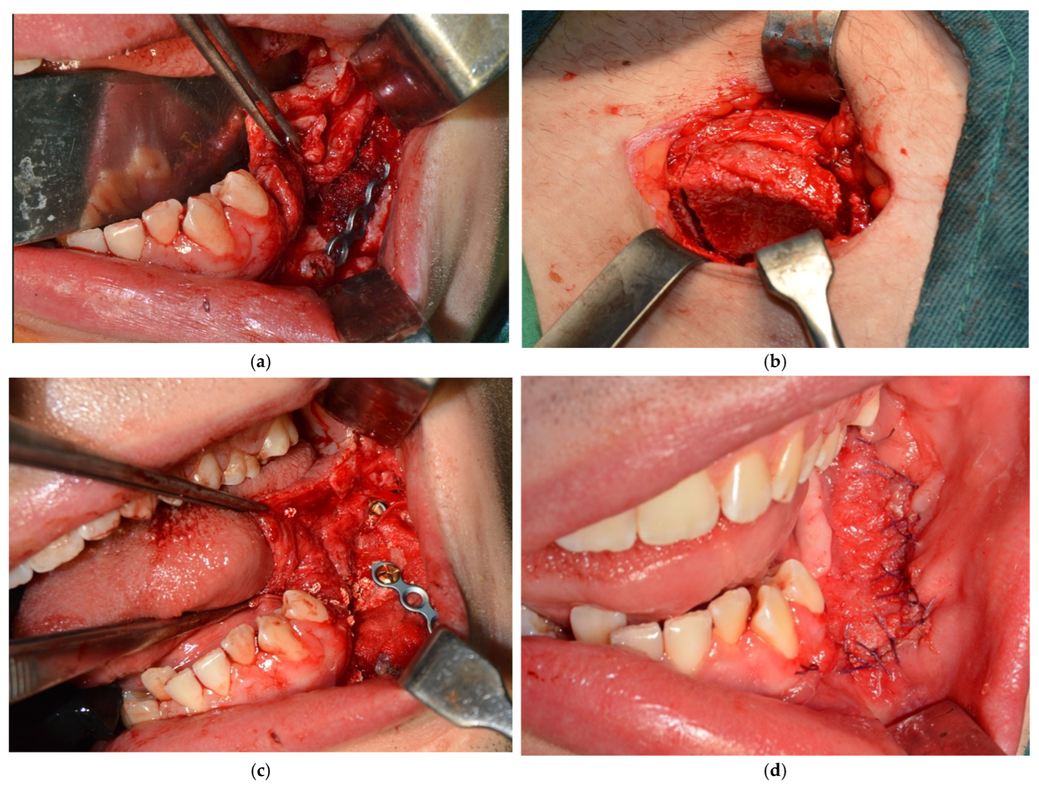 Dentistry 14 00039 g008