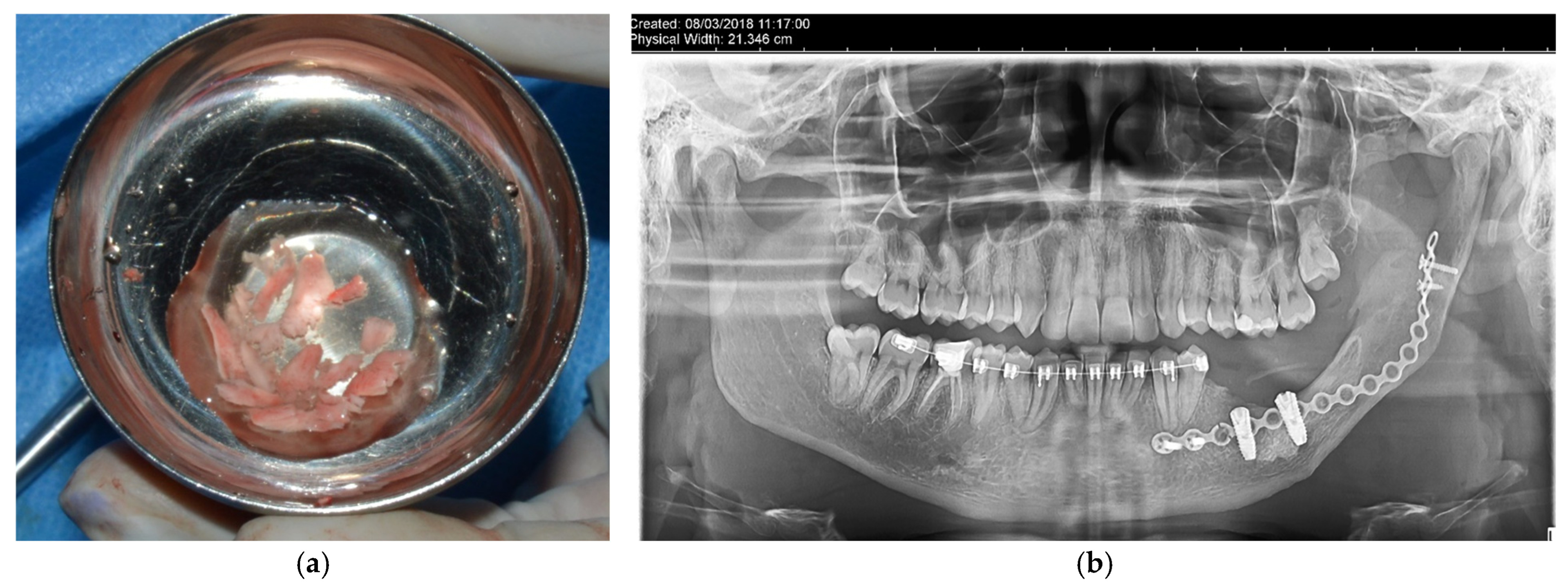 Dentistry 14 00039 g010
