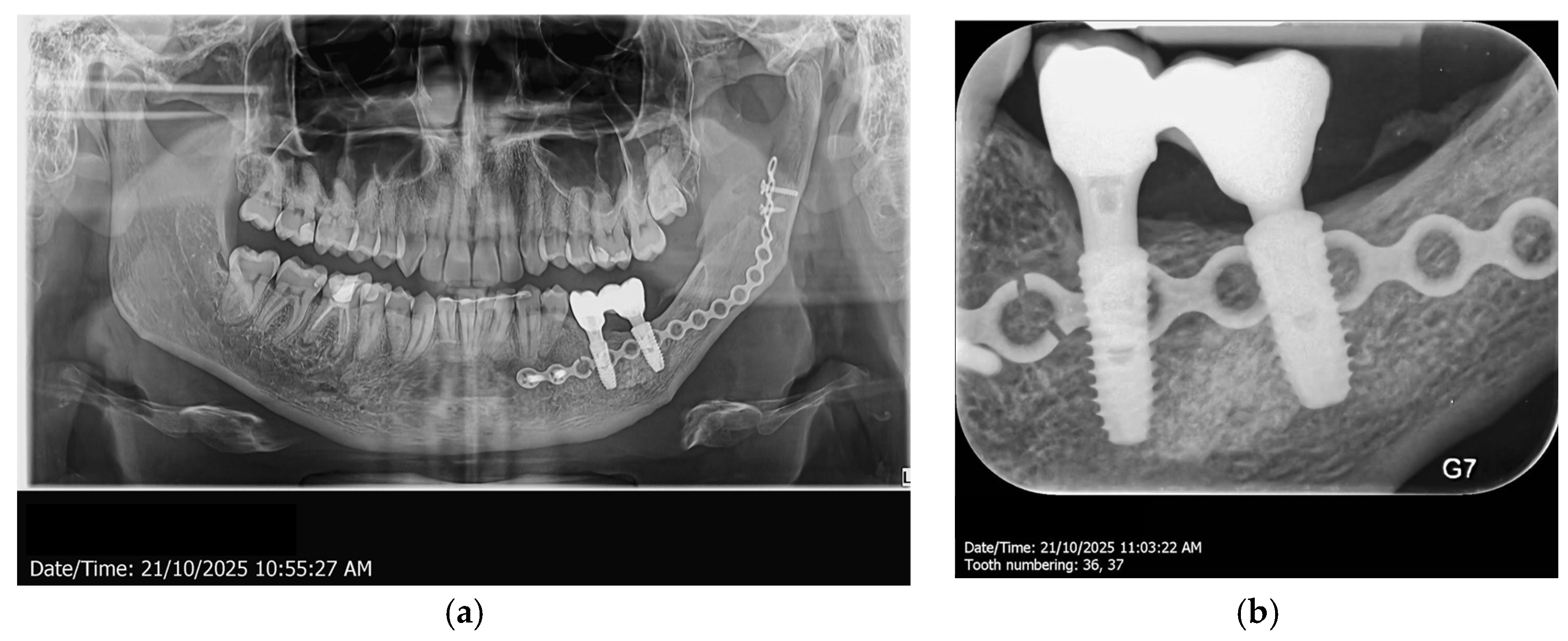 Dentistry 14 00039 g012