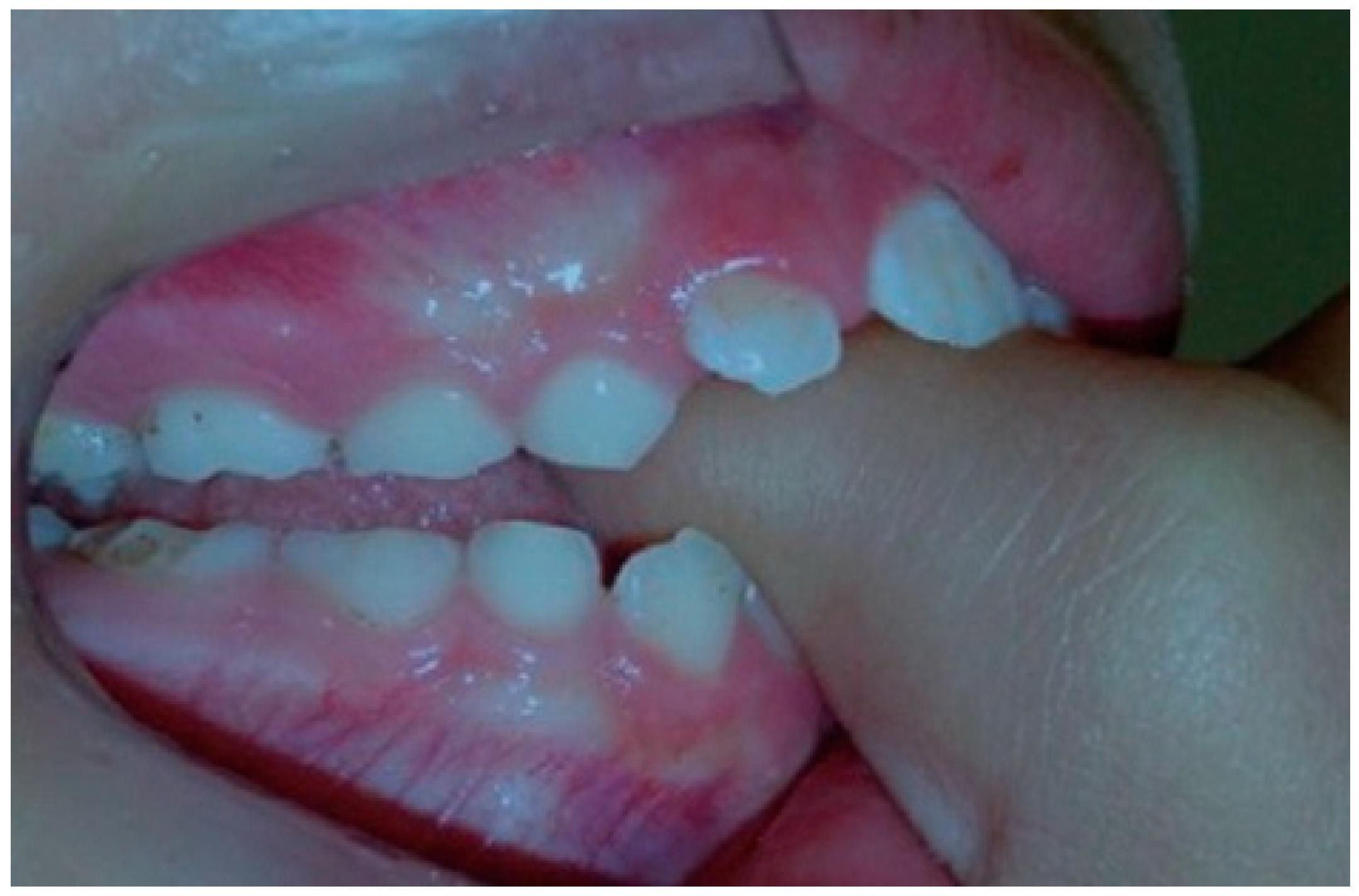 Dentistry 14 00055 g001