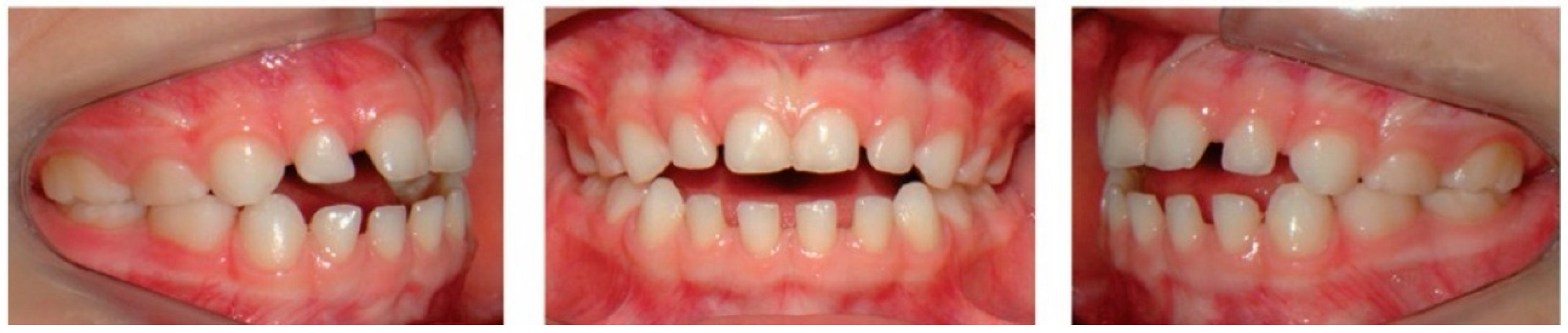 Dentistry 14 00055 g004