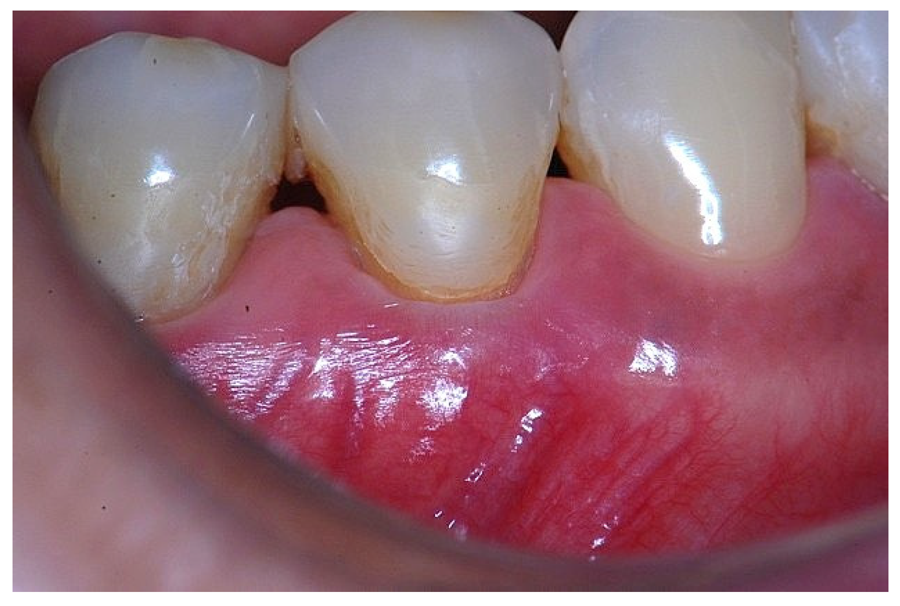 Dentistry 14 00156 g002