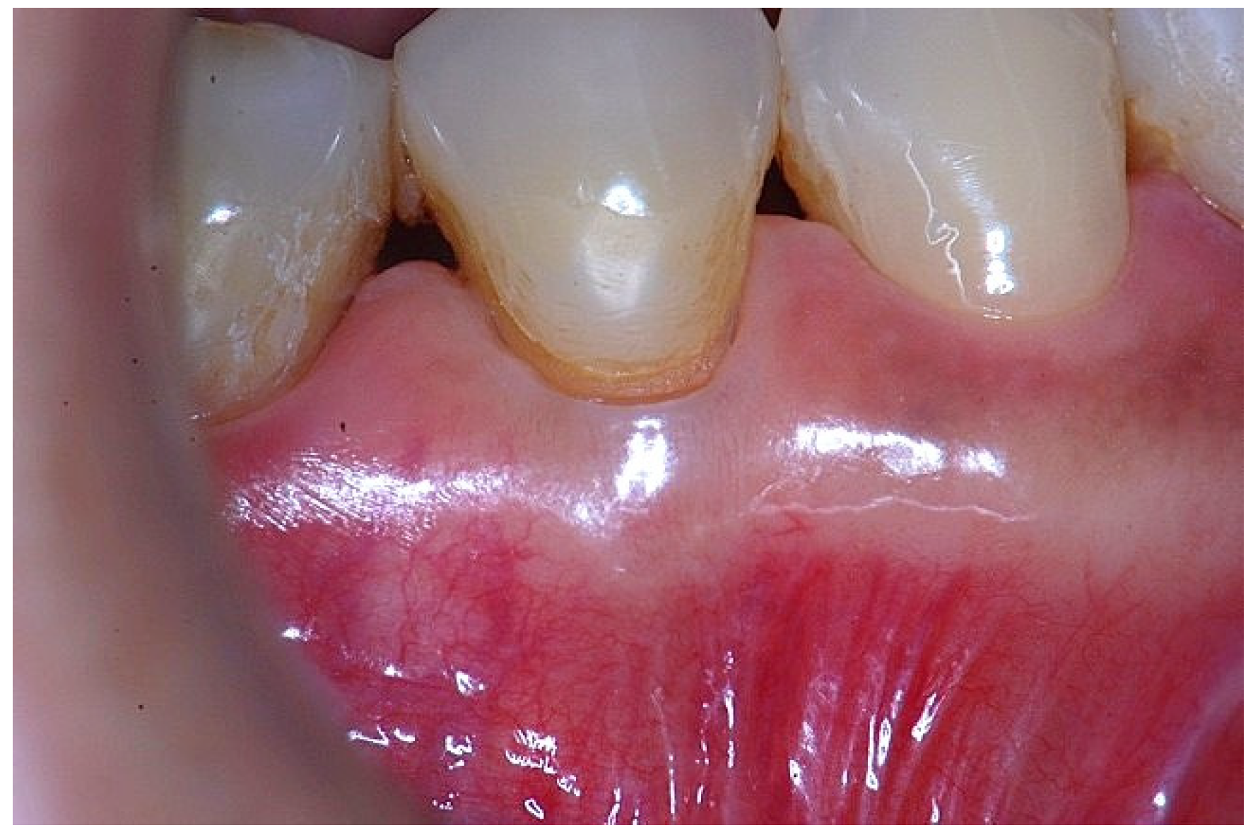 Dentistry 14 00156 g003