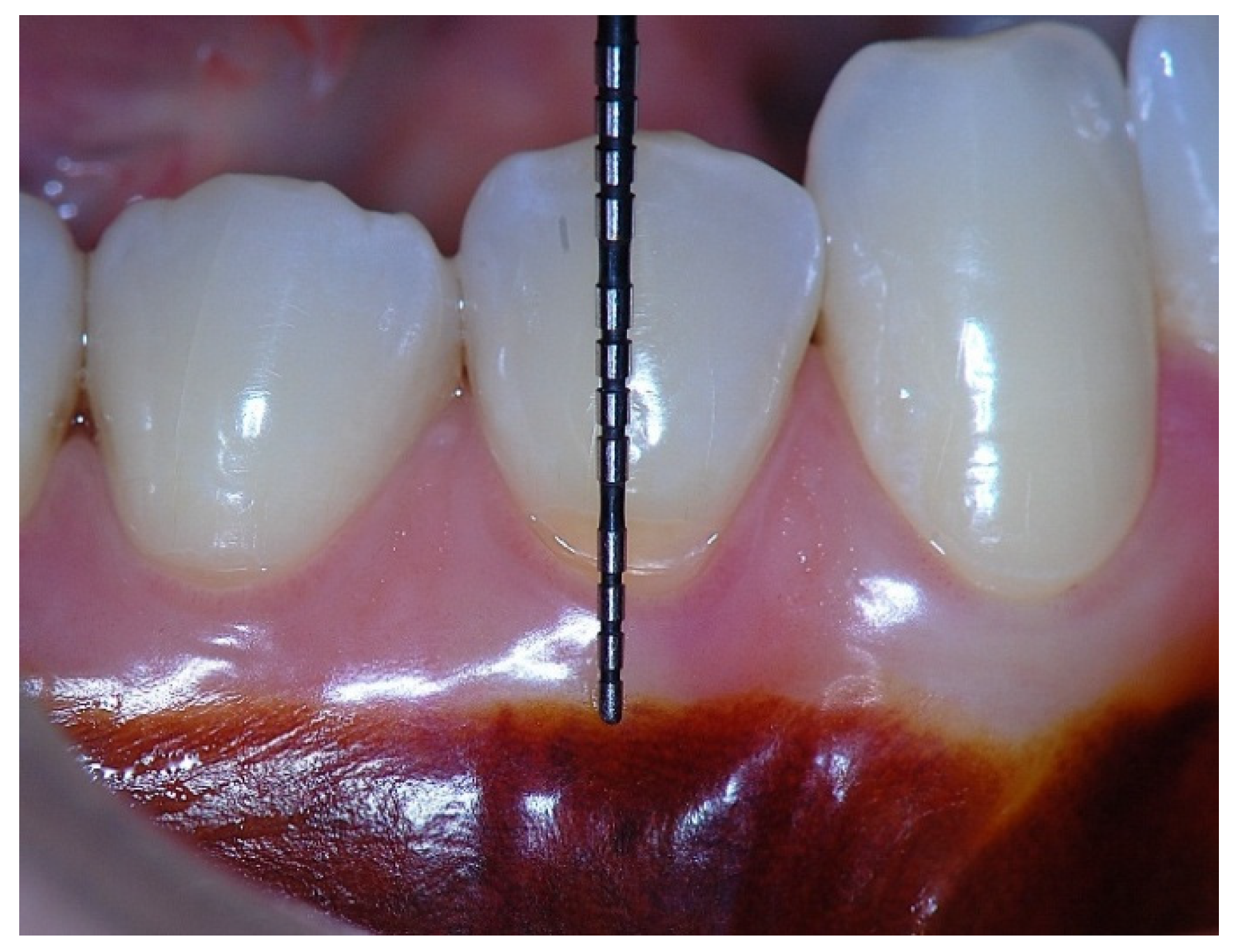 Dentistry 14 00156 g008