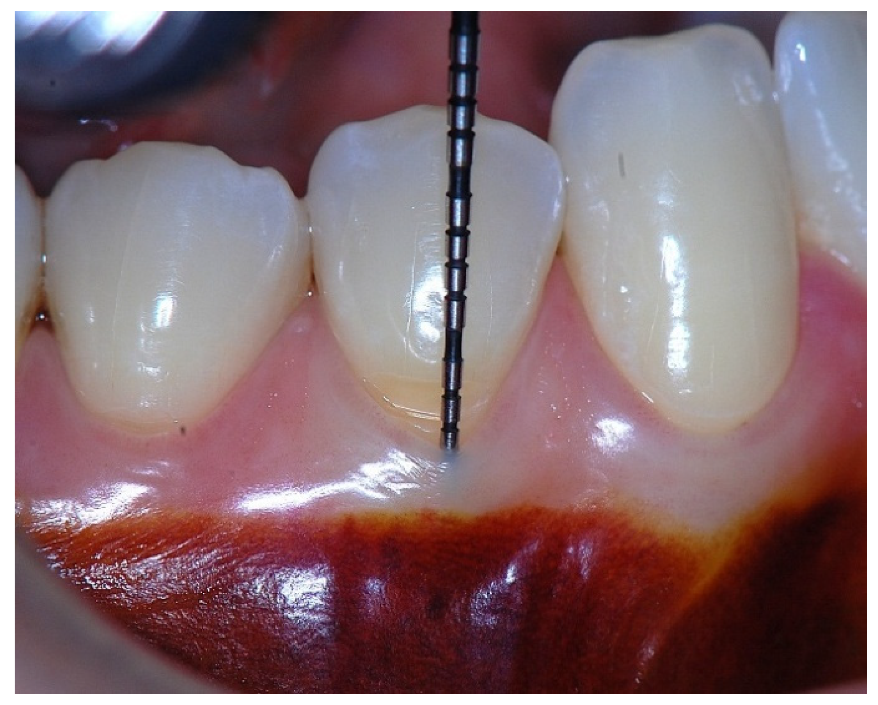 Dentistry 14 00156 g009