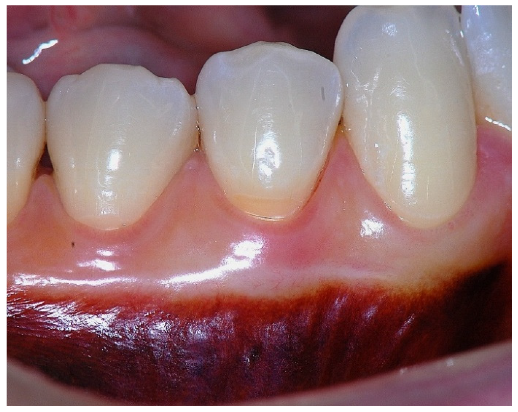 Dentistry 14 00156 g010