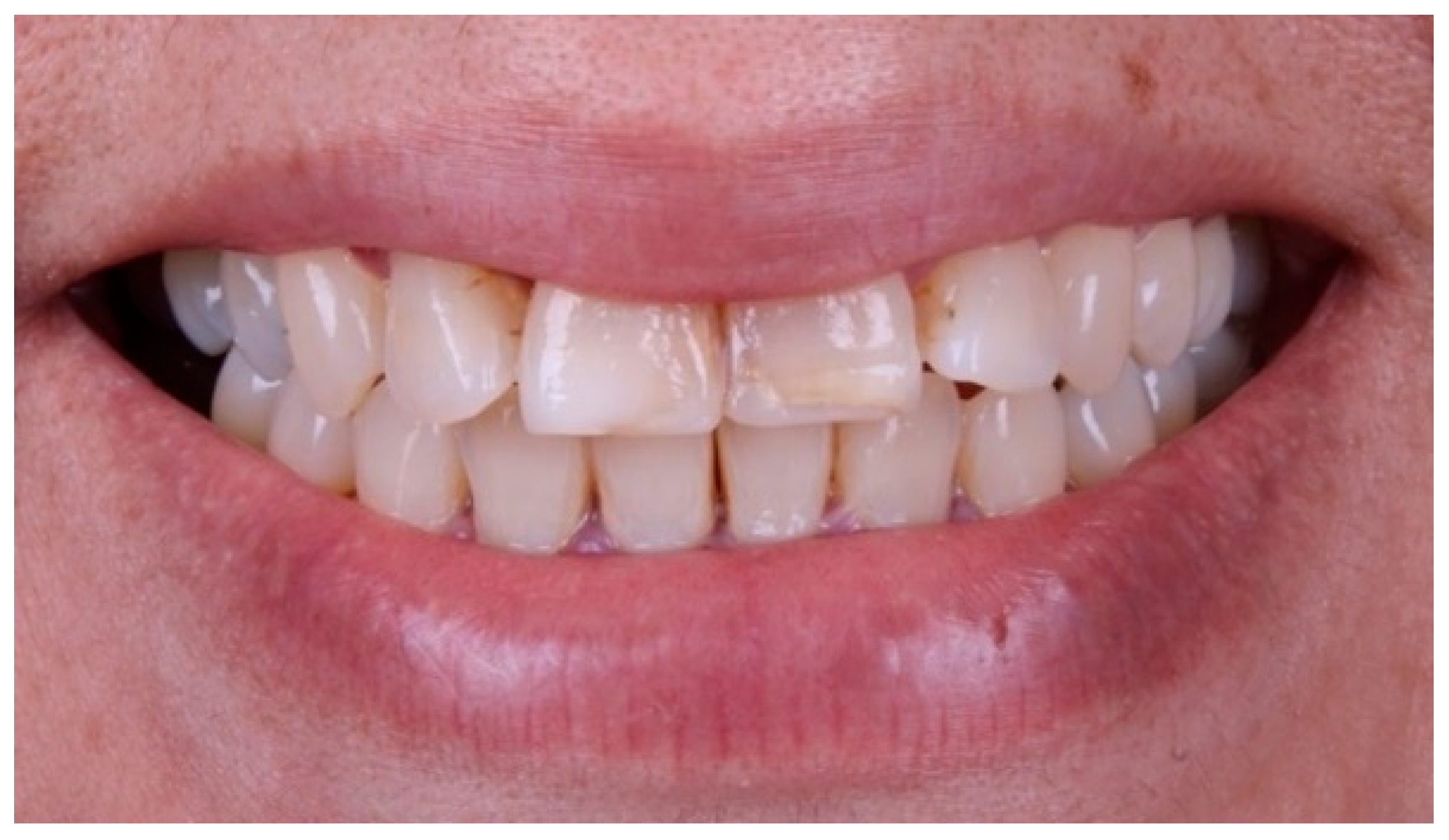 Dentistry 14 00175 g001