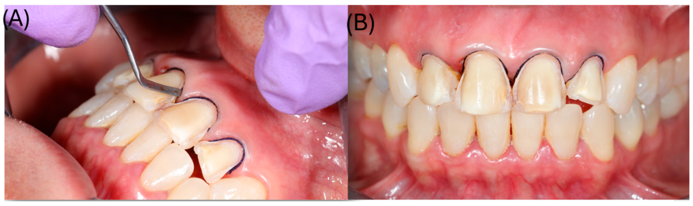 Dentistry 14 00175 g005