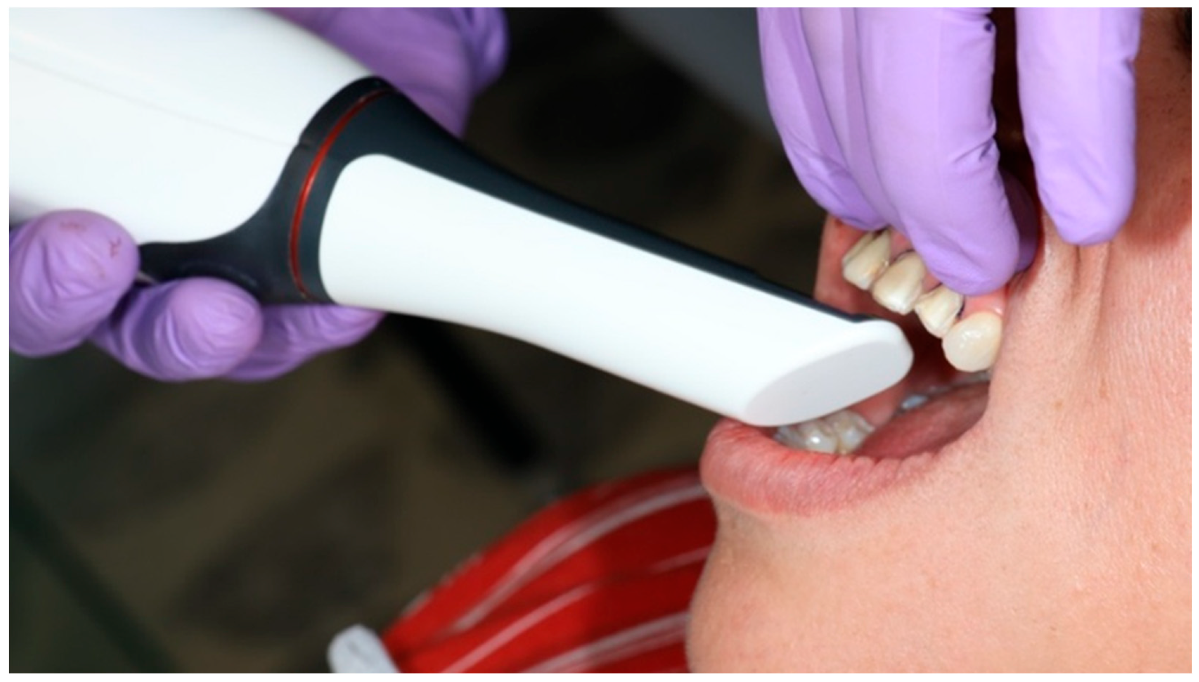 Dentistry 14 00175 g006