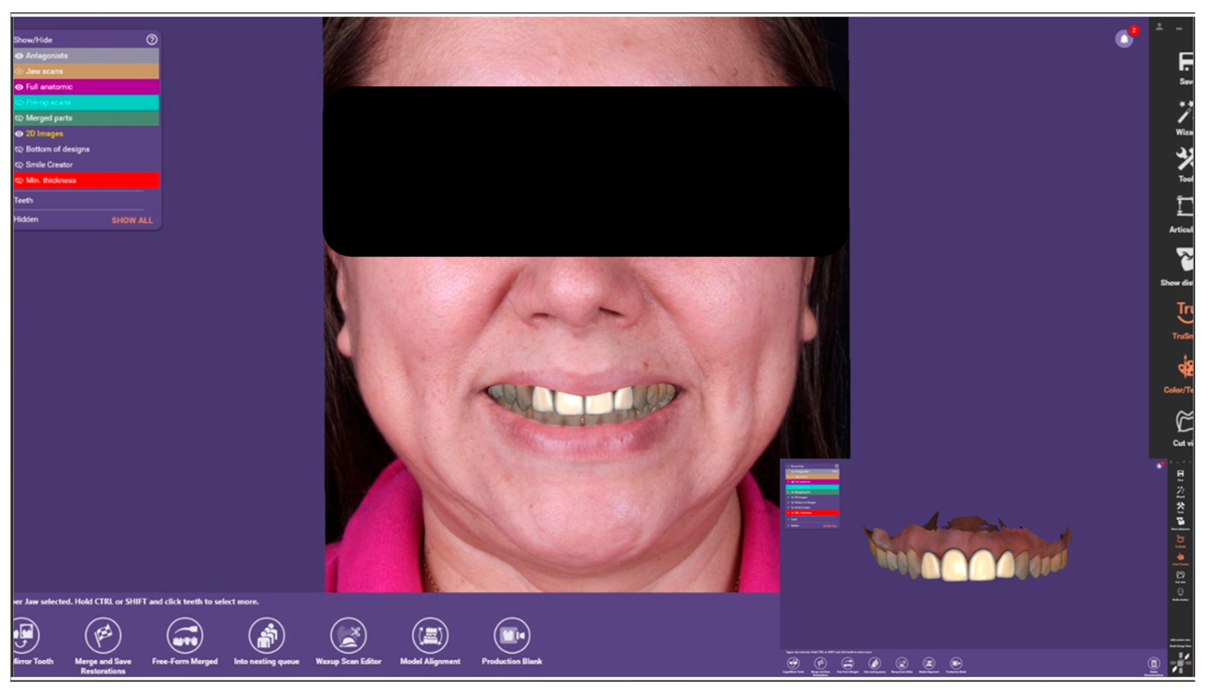 Dentistry 14 00175 g008