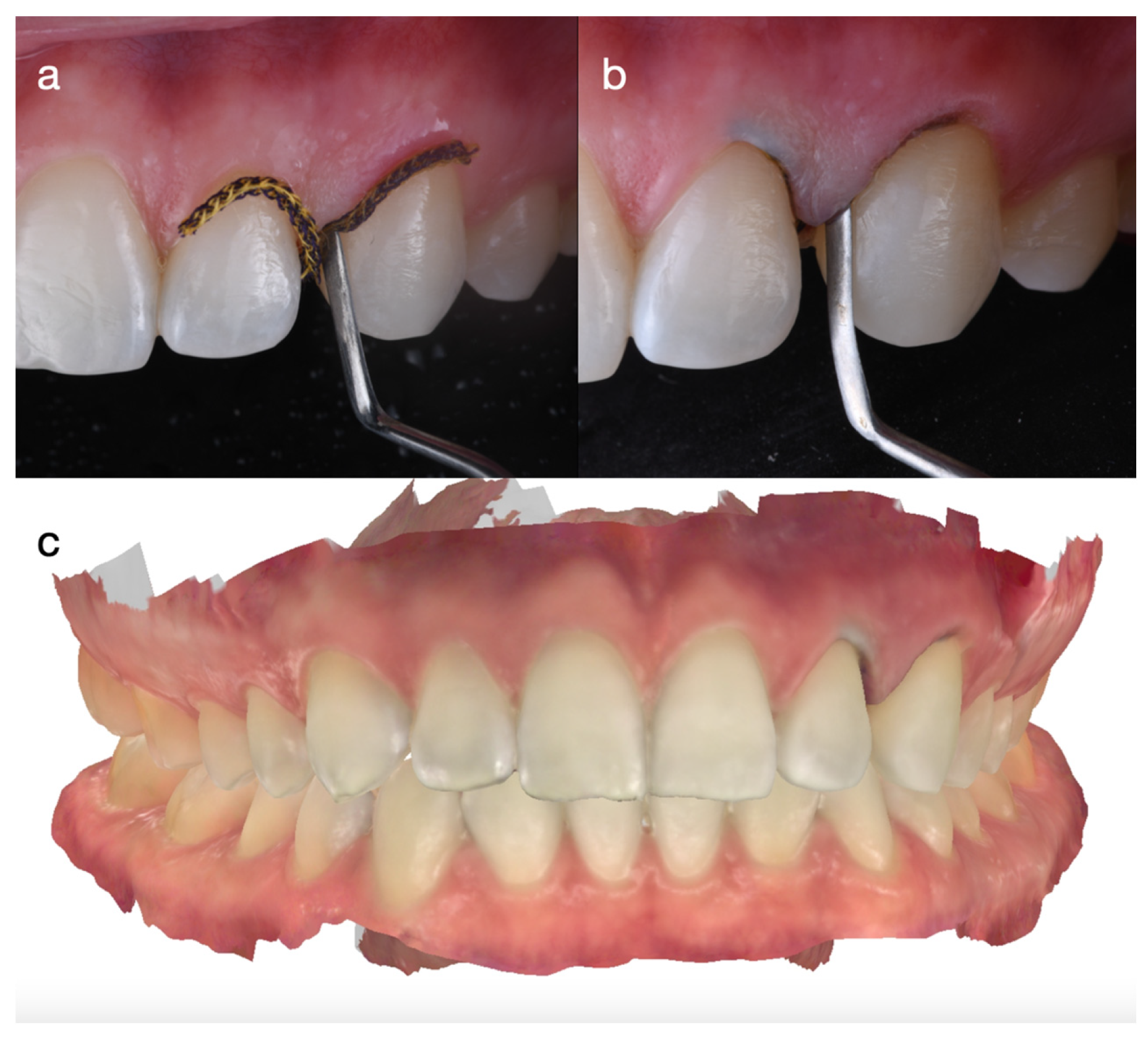 Dentistry 14 00186 g006