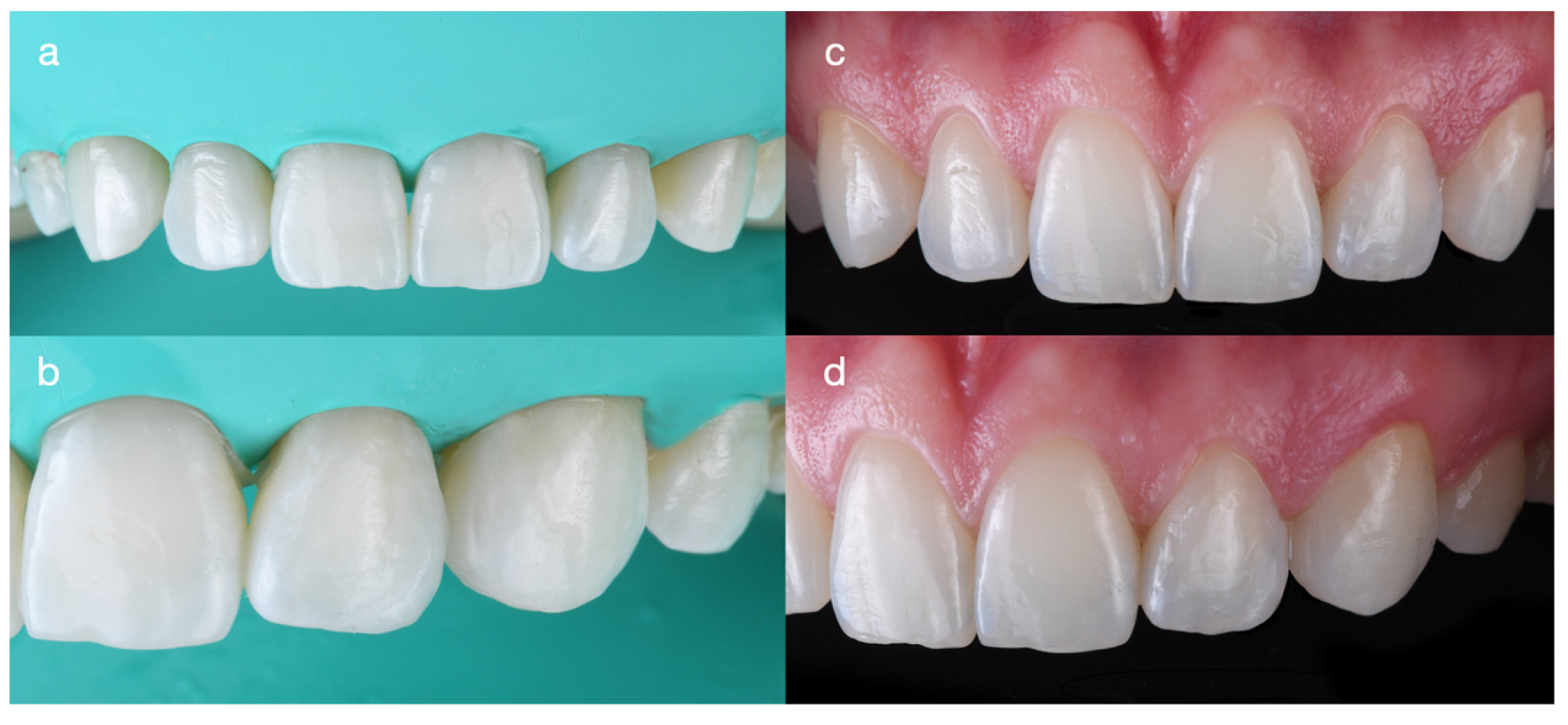 Dentistry 14 00186 g008