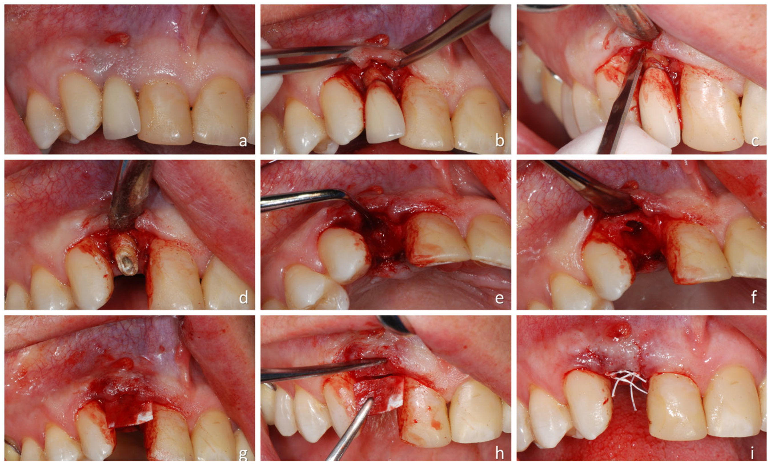 Dentistry 14 00193 g001