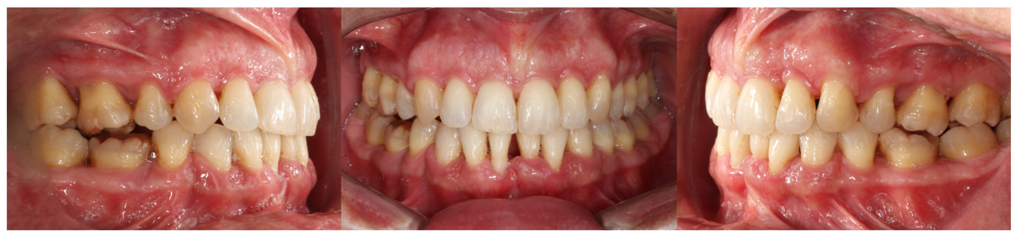 Dentistry 14 00197 g013