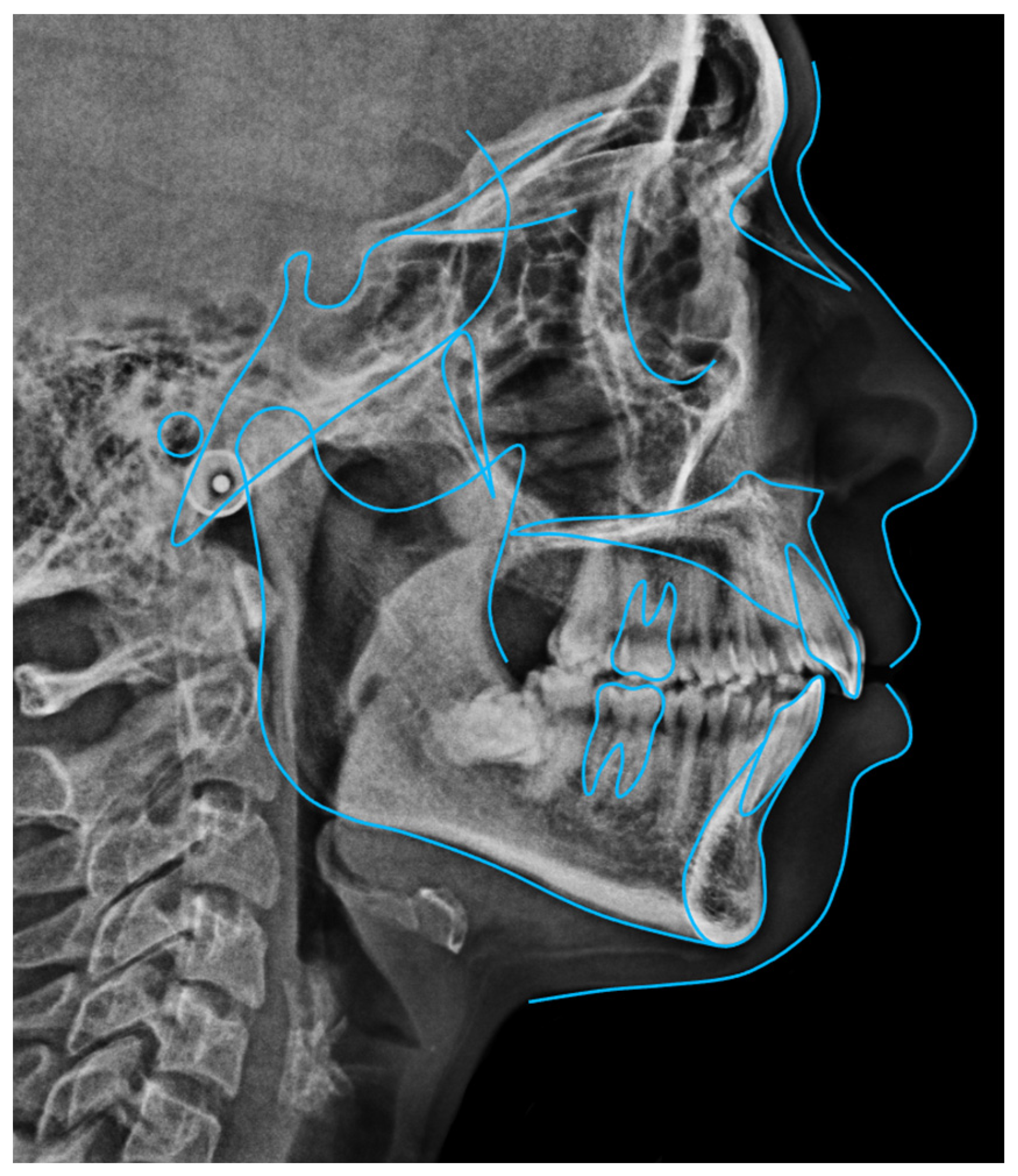 Dentistry 14 00197 g020
