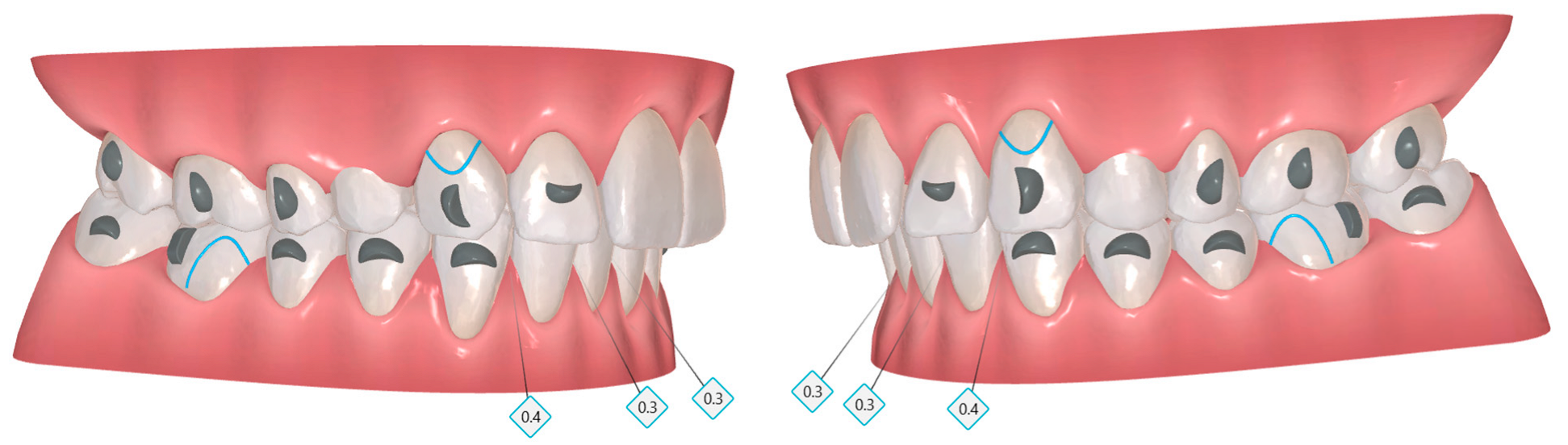 Dentistry 14 00197 g022