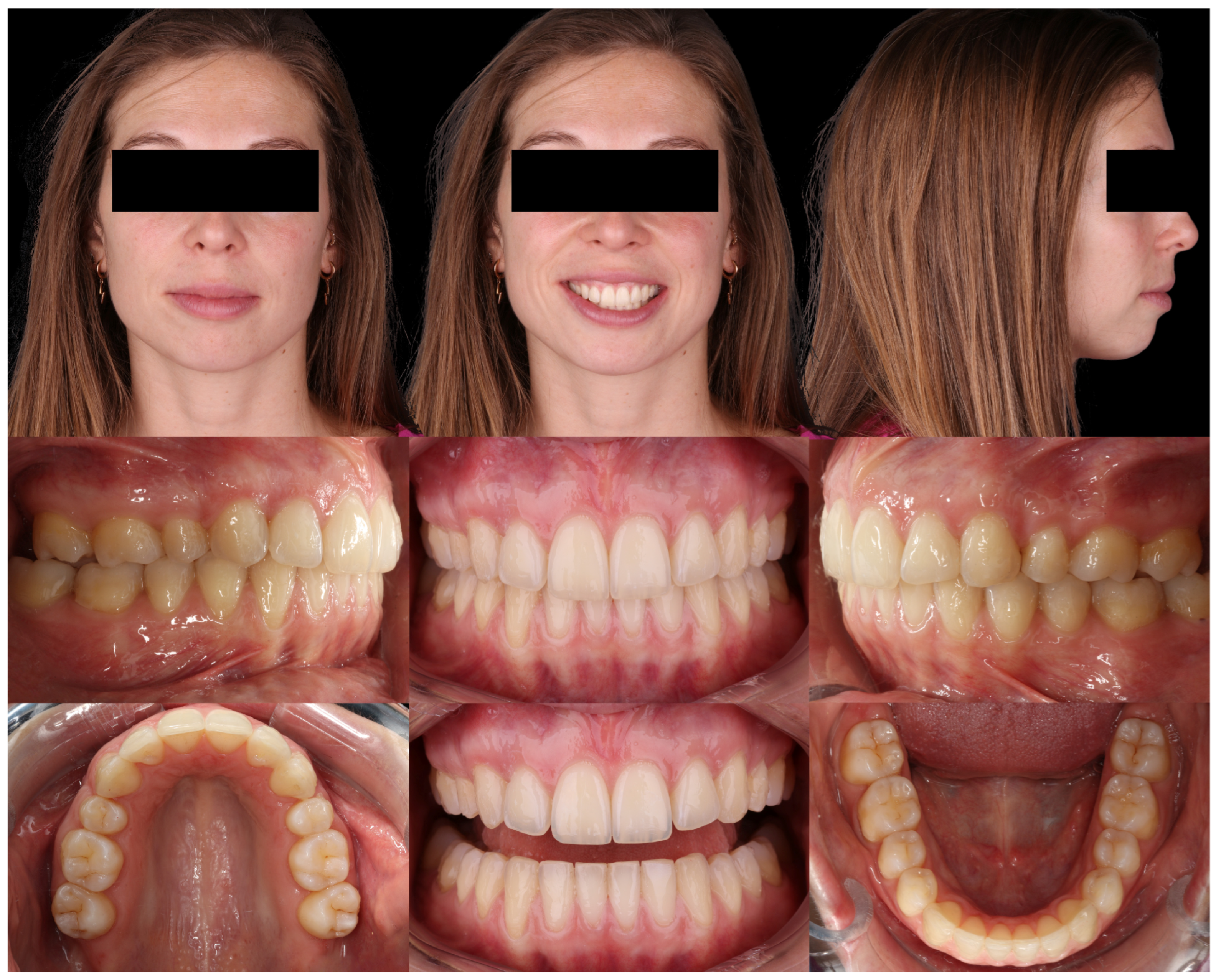 Dentistry 14 00197 g026