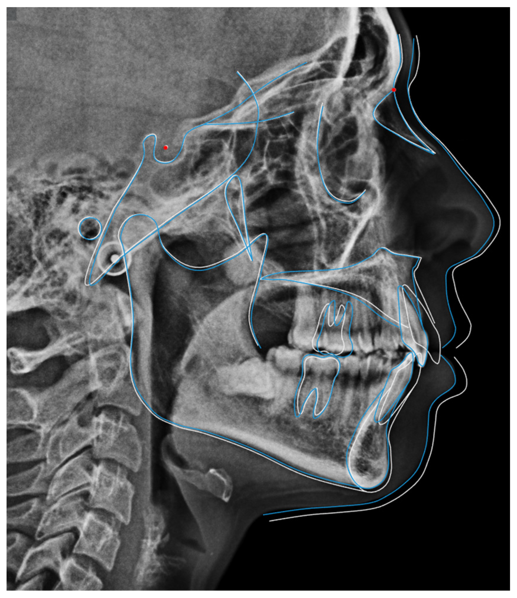 Dentistry 14 00197 g028