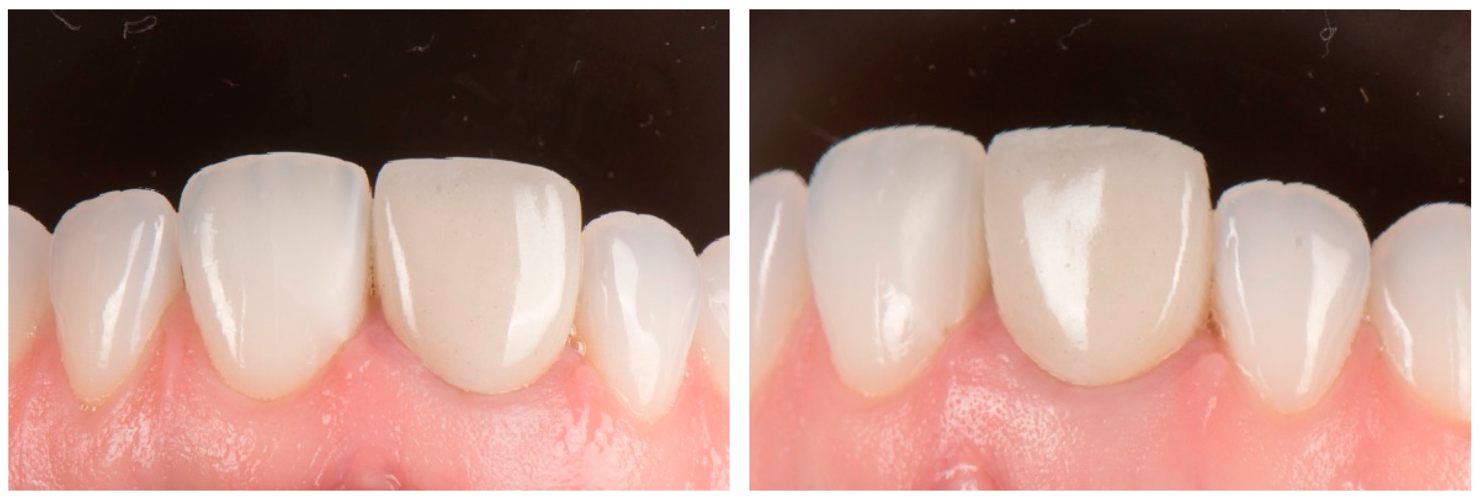 Dentistry 14 00205 g001