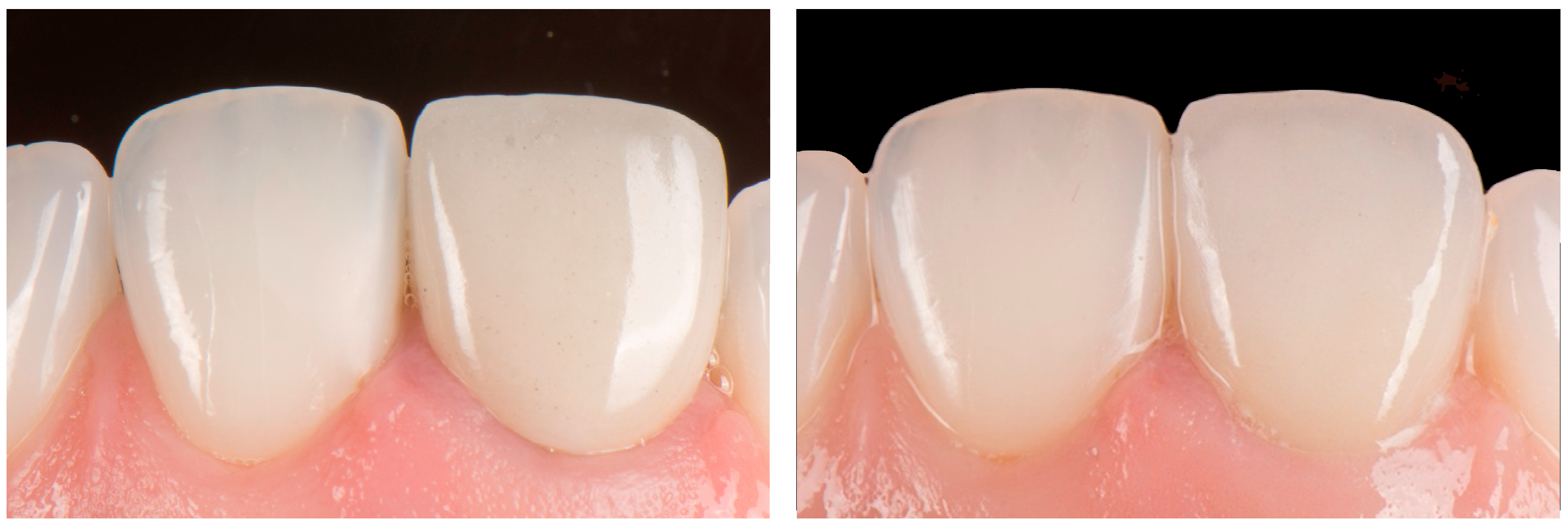 Dentistry 14 00205 g008